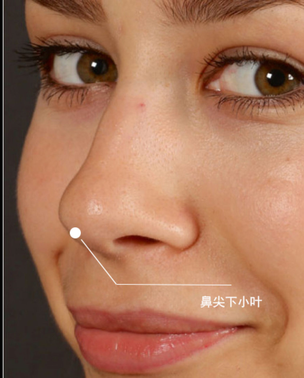 它是指鼻子下部与面颊交界处的区域,通常是指鼻翼两侧靠近鼻孔的区域.