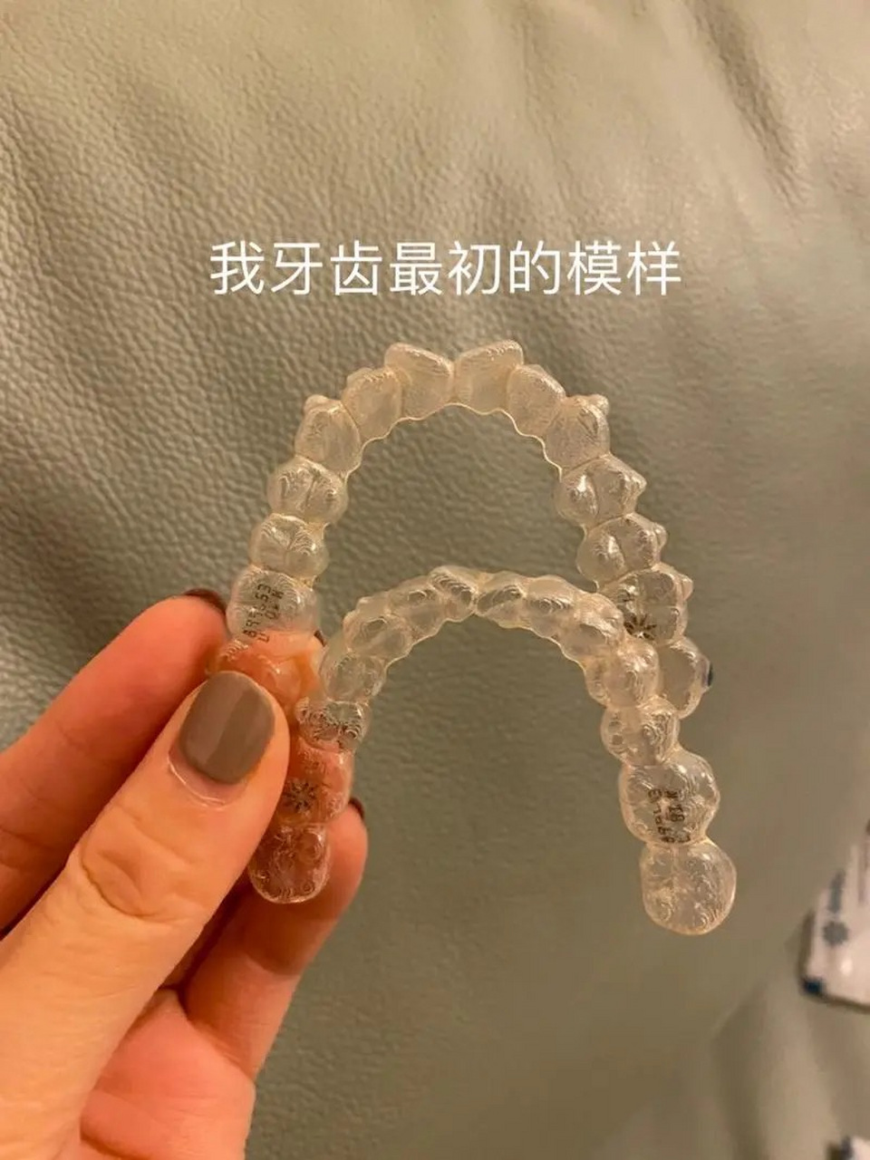 隐适美隐形牙套的价格一般来说价格在3.