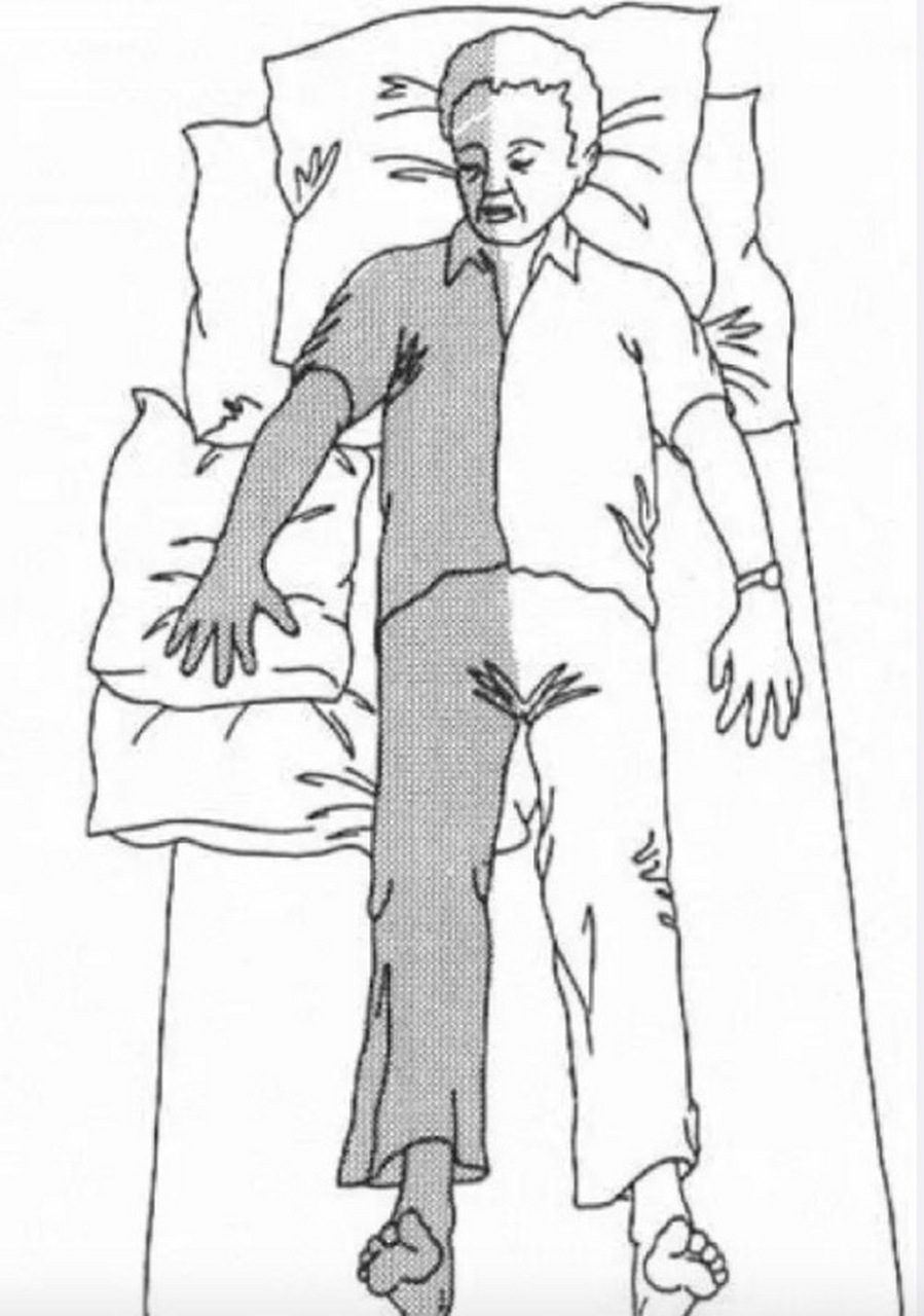 脑梗偏瘫后,请保持瘫痪肢体的正确位置 #百度知识充电节#,#百度付费