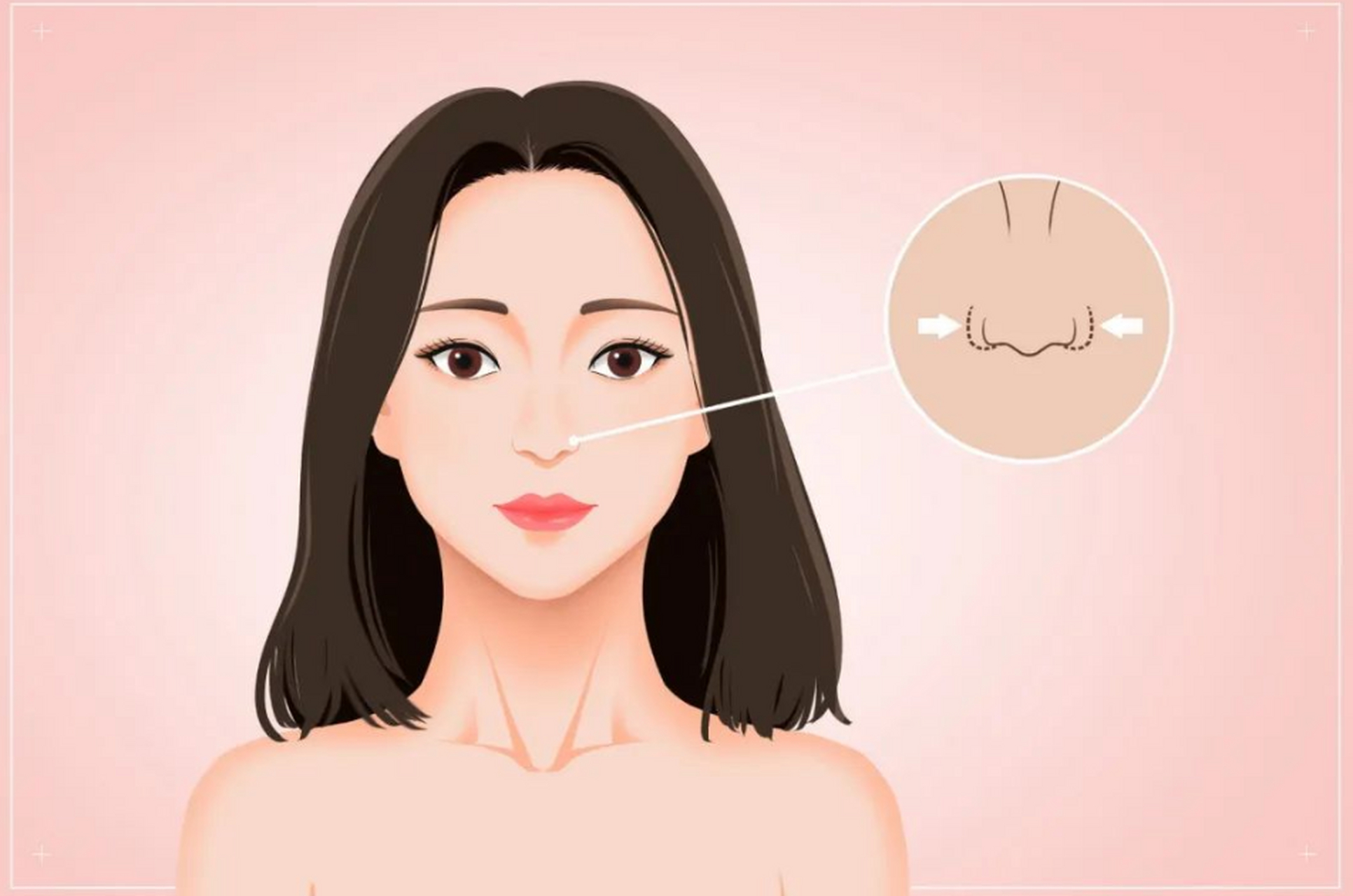 杭州任东医生做鼻子在哪个医院