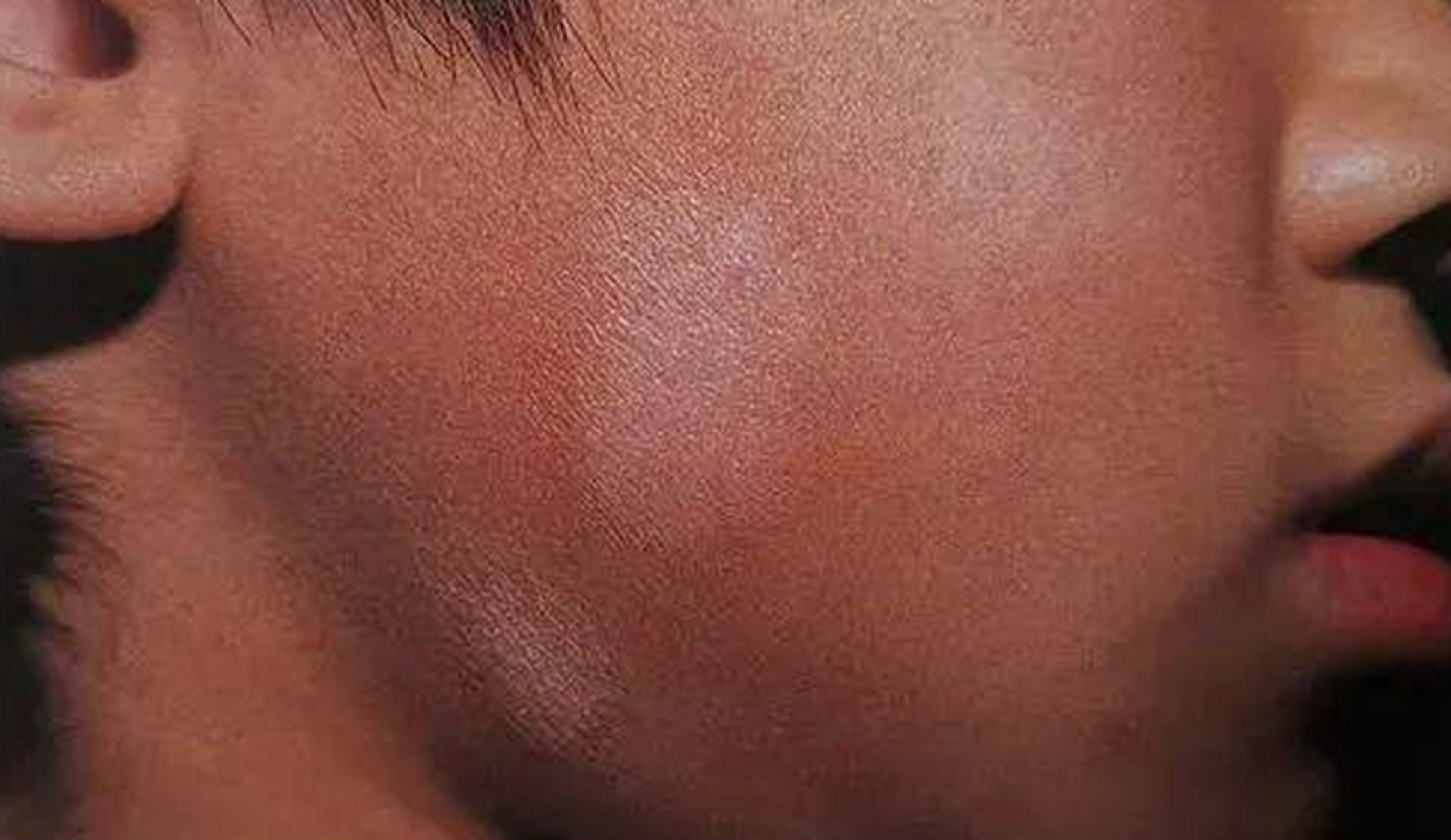 图上的3种白斑属于哪种皮肤病?