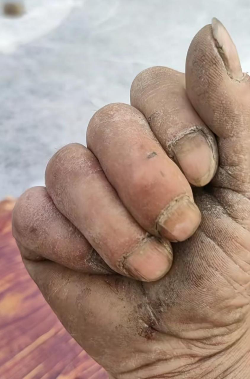网友:这就是劳动人民的手啊,发一张你们上班后的手成什么样了?