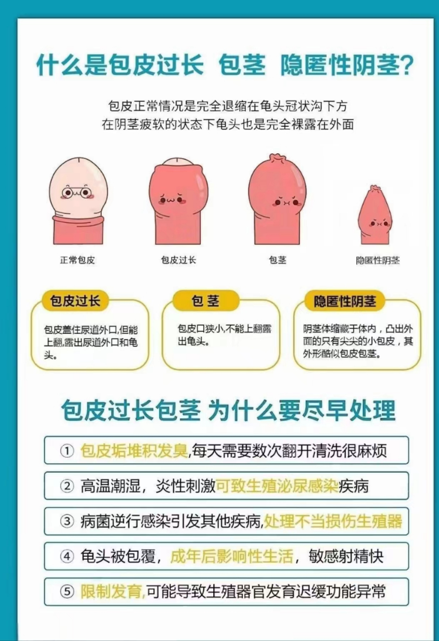 什么情况是包皮过长,或者包茎?[疑问] 什么情况是隐匿性阴茎?