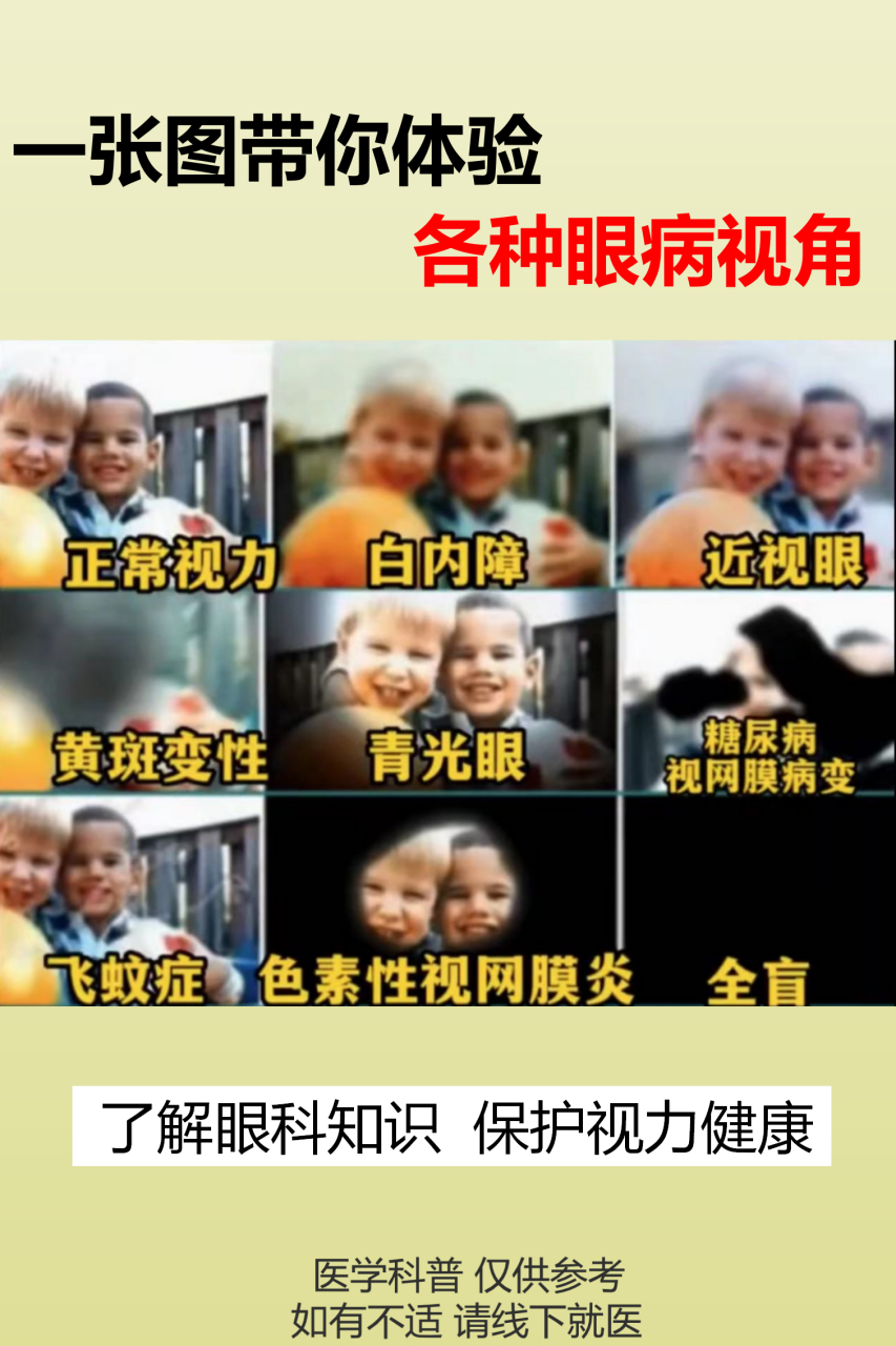 一张图带你体验 各种眼病视角  #眼病# #中医眼科# # #眼科
