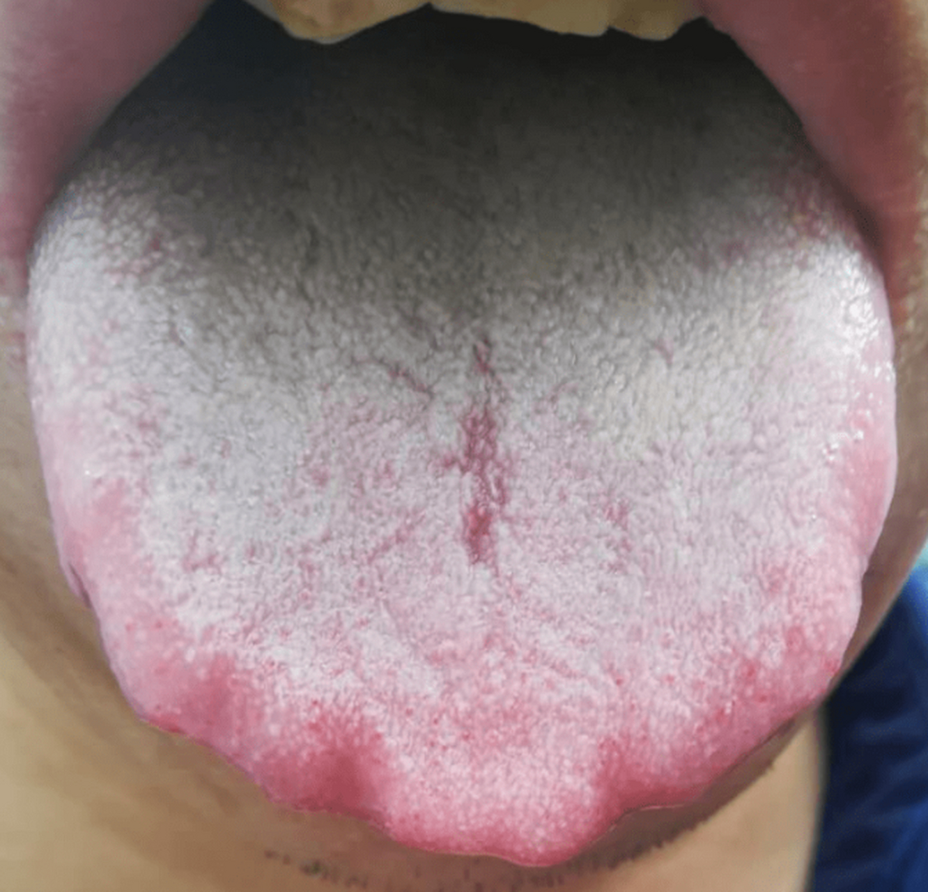 脾胃好不好,看看舌头就能知道 我们常说"舌尖上的美食",但你知道吗?