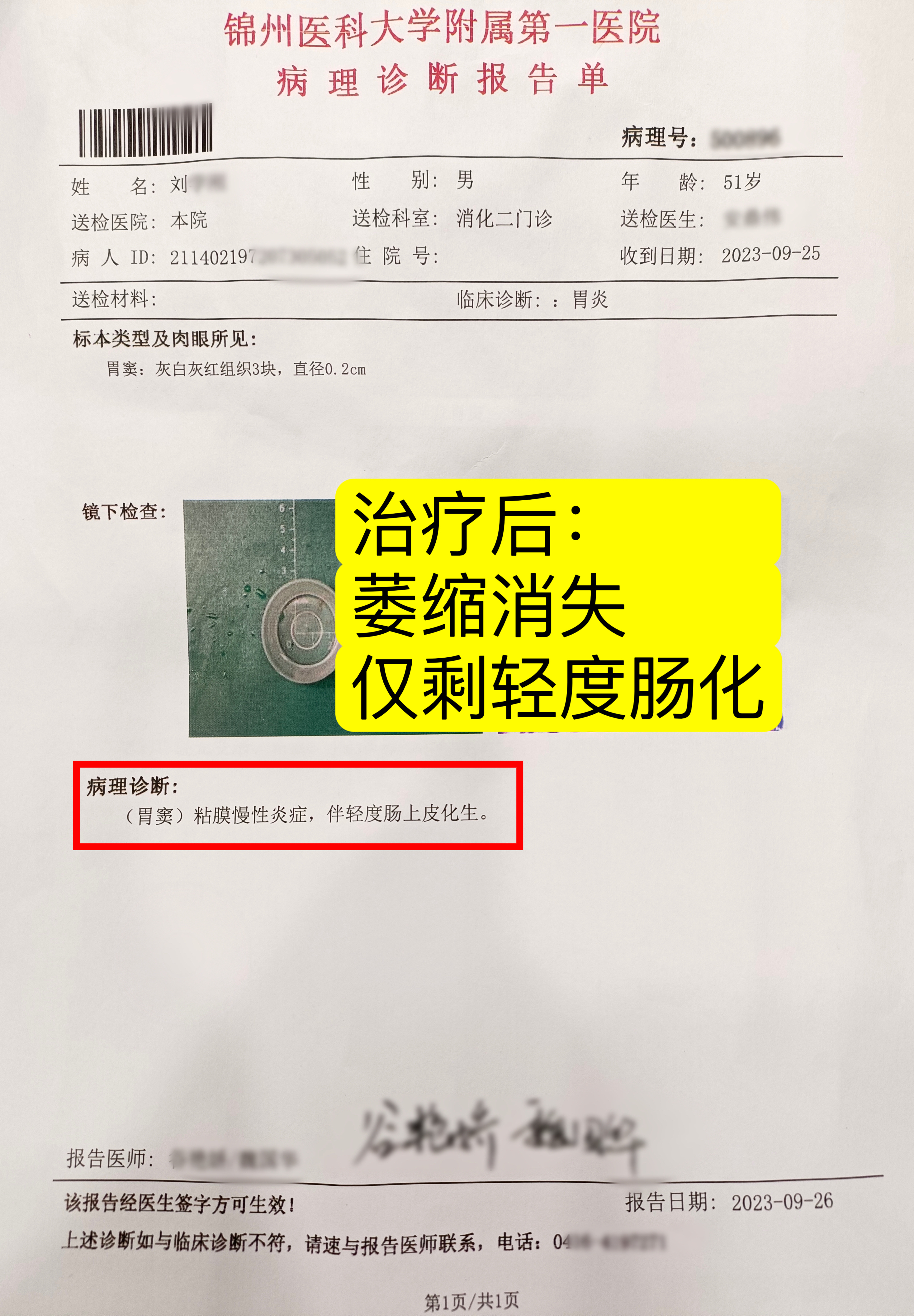 刘先生,51岁,治疗前胃镜检查报告显示: 萎缩性胃炎c2型伴肠化生,反