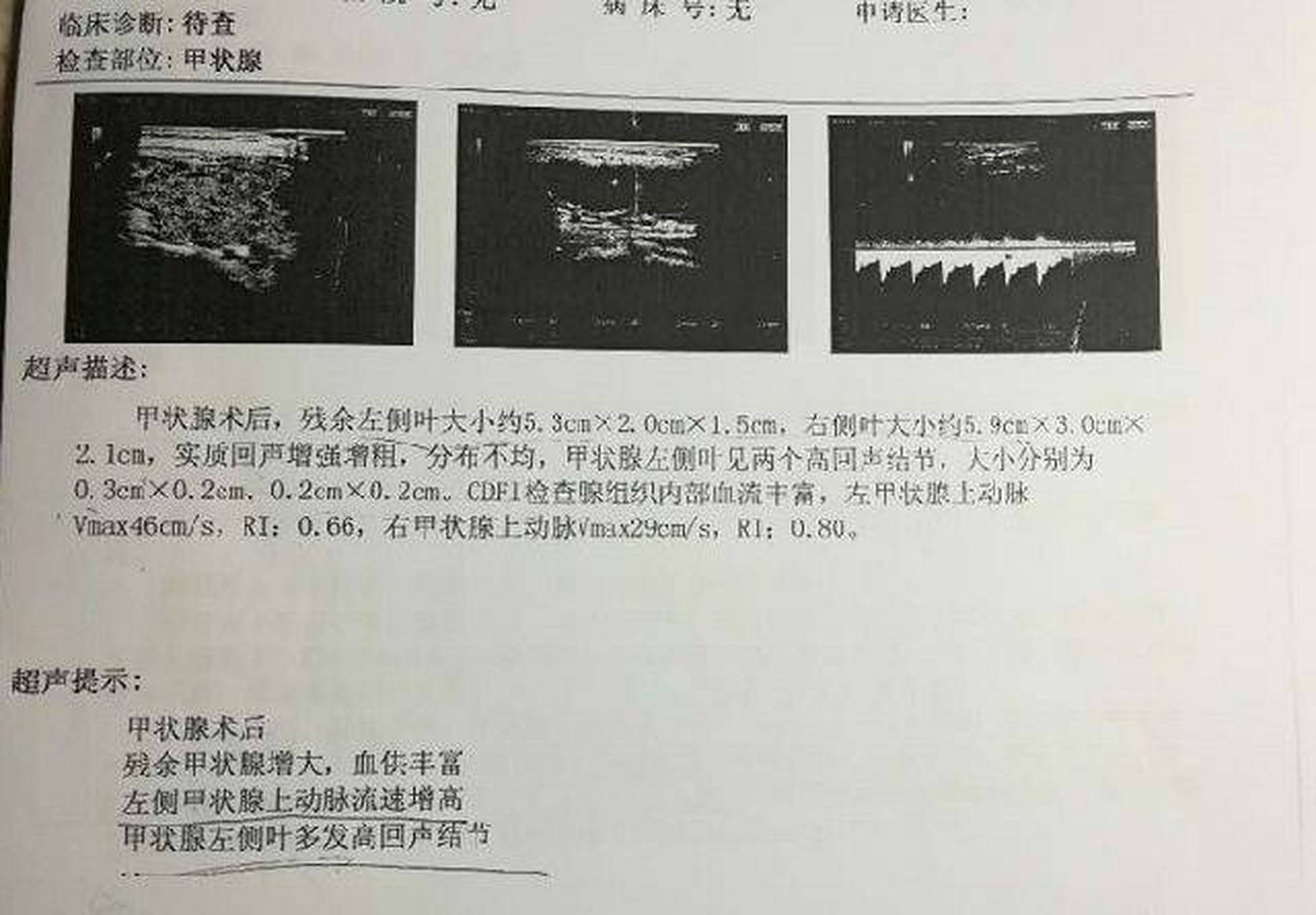 甲状腺有结节不知道怎么办? 做了检查,但是看不懂报告单的描述?