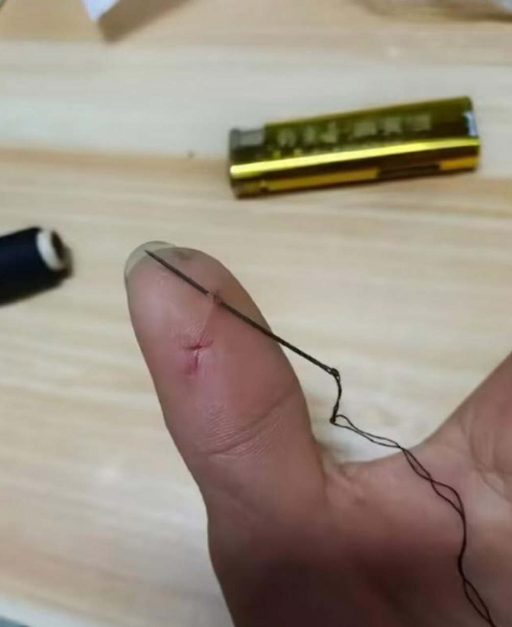 大家觉得我给自己手指缝针的技术怎么样