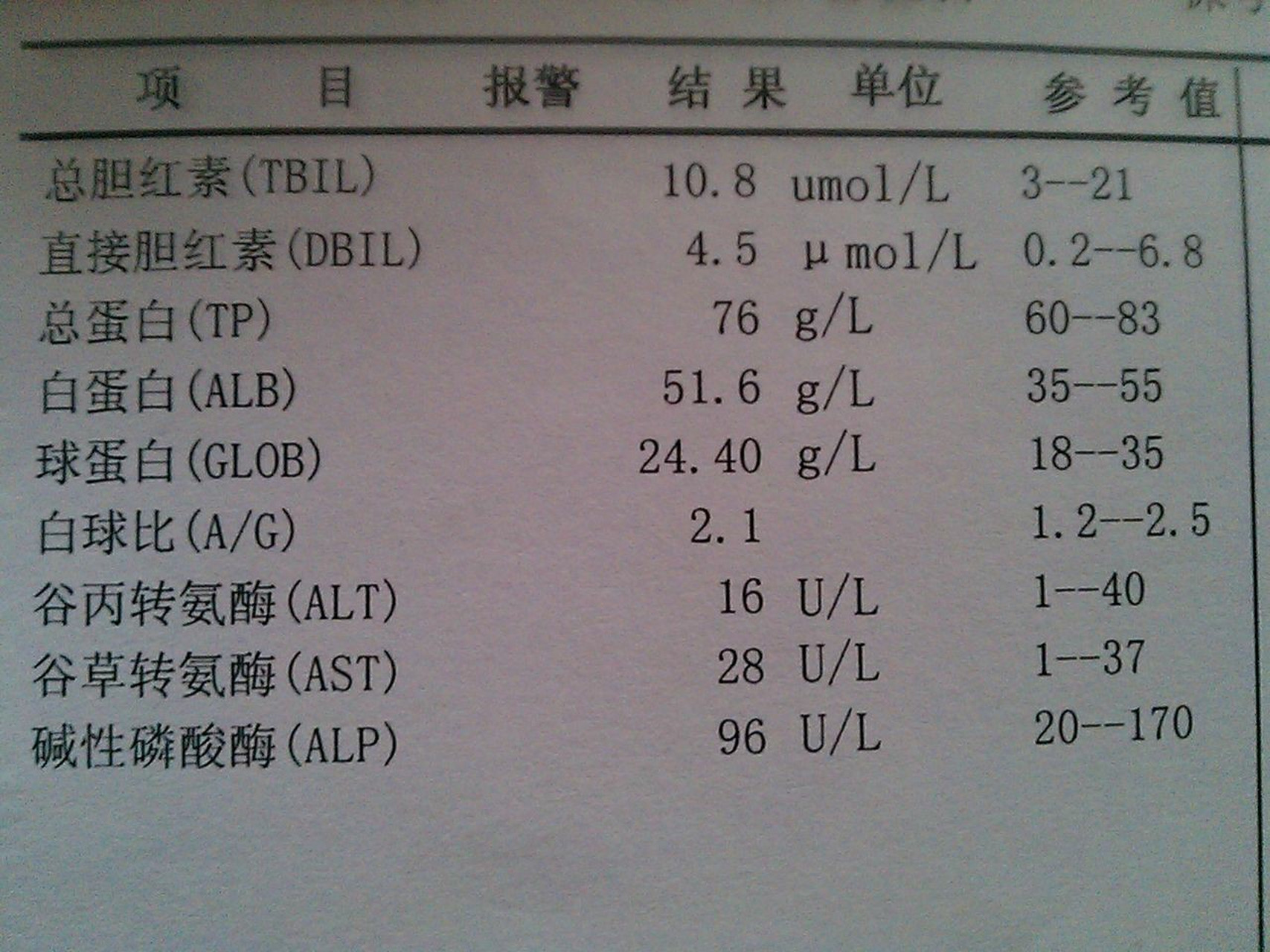希望你的肝功能化验单不要出现这三种情况 1看转氨酶,主要是谷丙