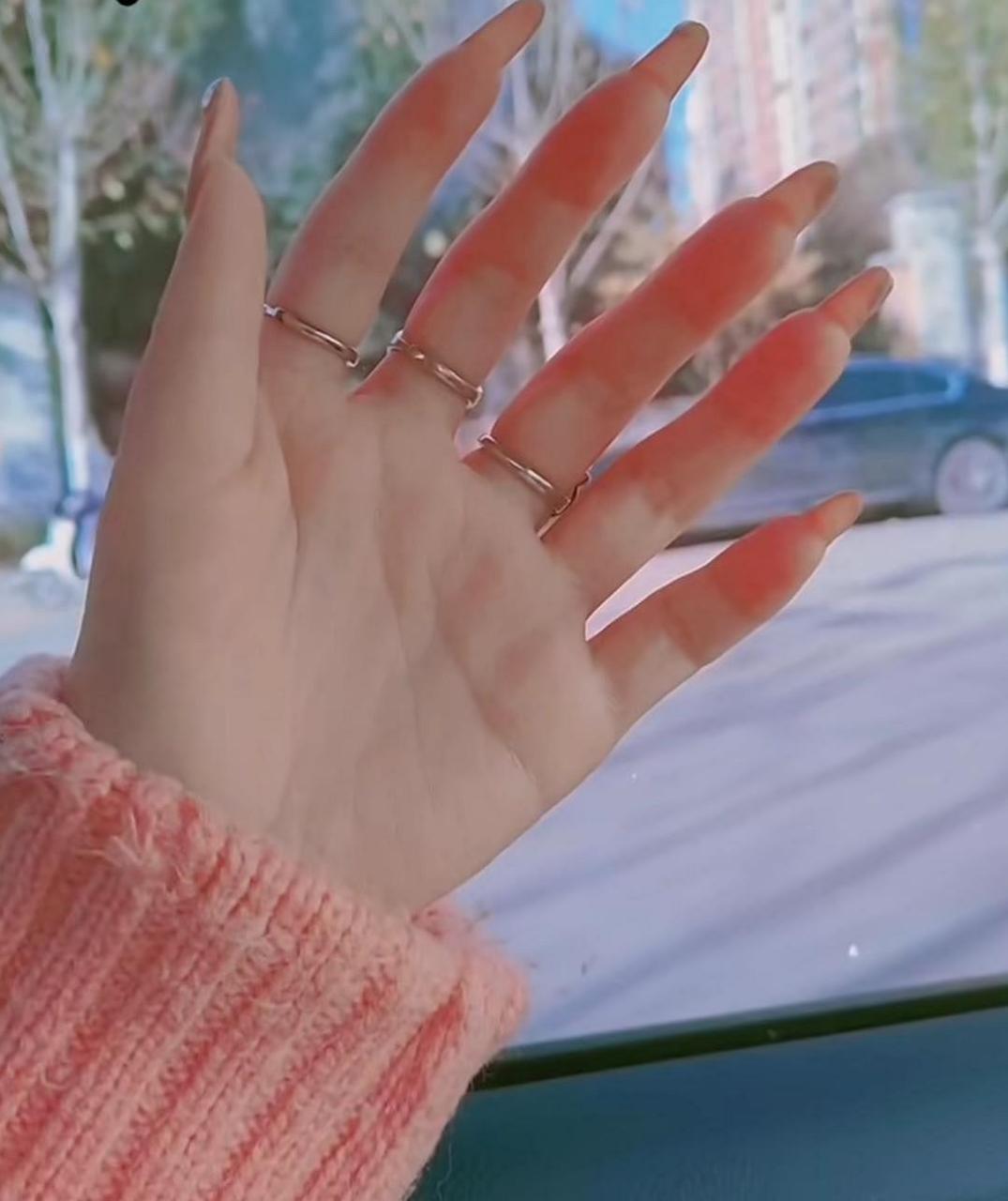 网友:天生六个手指头,也没有什么不好看的,而且还挺方便的[三哈]