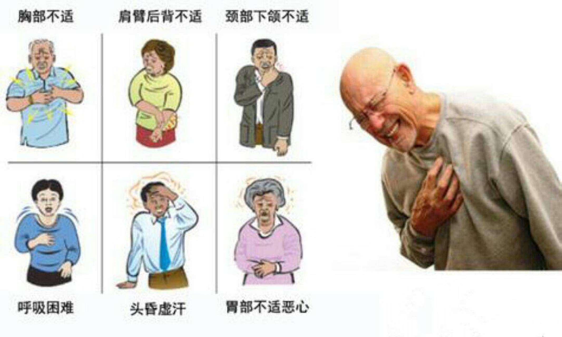 胸痹图片图片