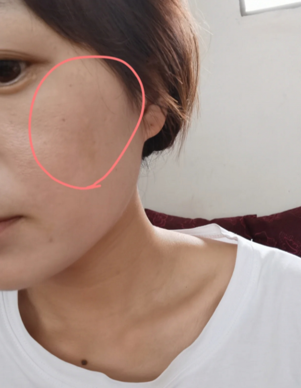 黄褐斑是让人苦恼的皮肤问题之一,特别是出现在脸颊上时更加令人烦恼.