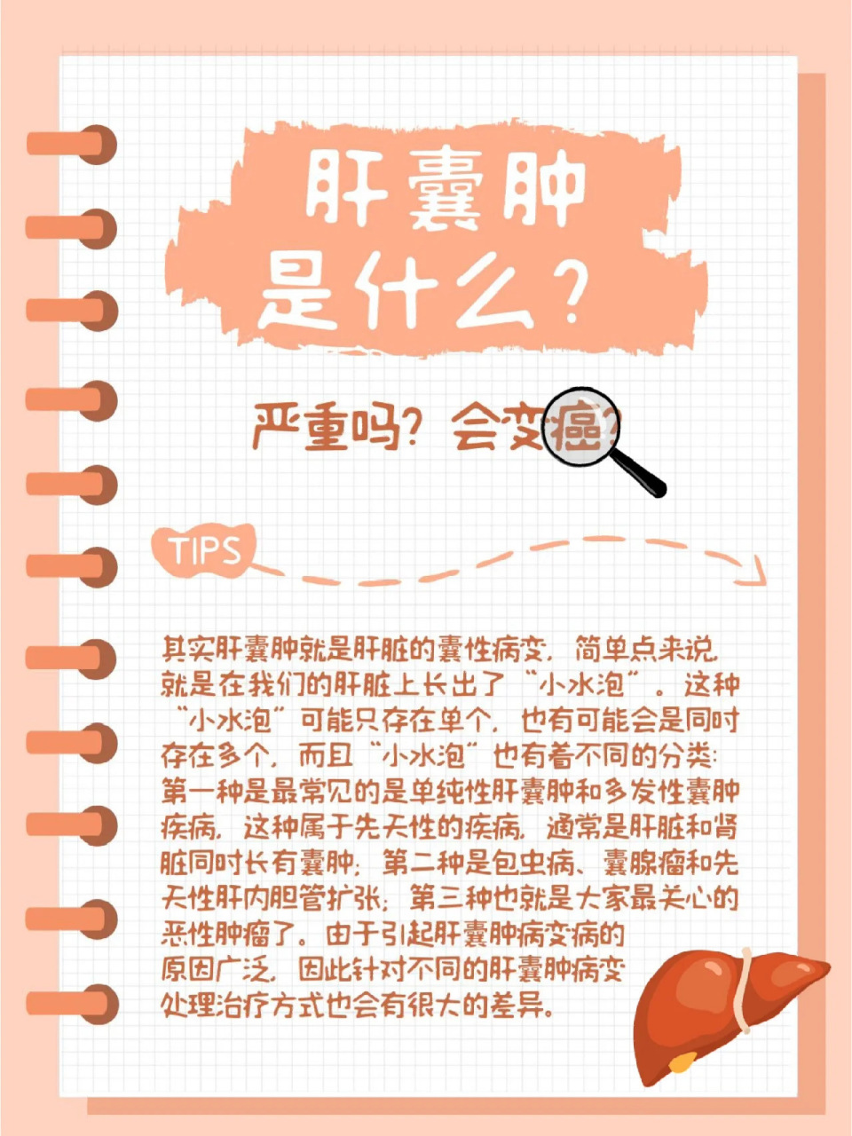 肝囊肿是什么?会变癌?