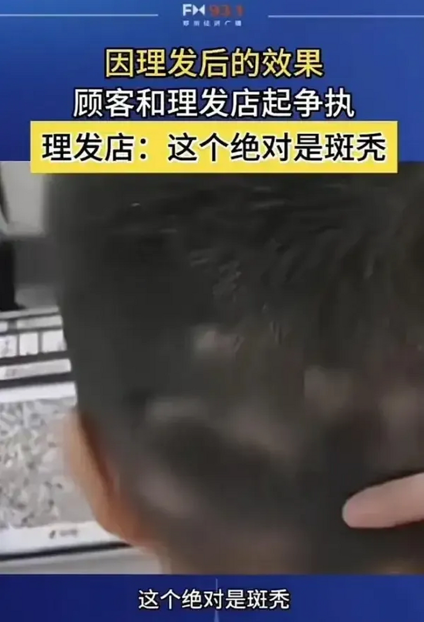 理发后脑勺凹凸不平,理发店称是斑秃,这是真相还是借口?