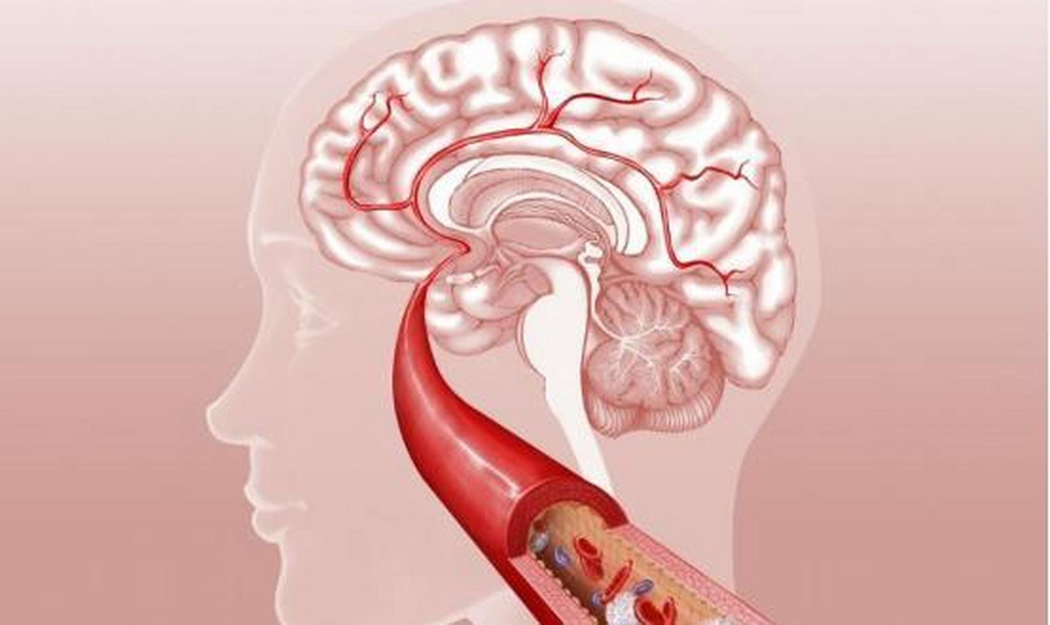 脑供血不足,早期有7大表现: 1,入睡困难或早醒,睡眠不踏实,易做噩梦