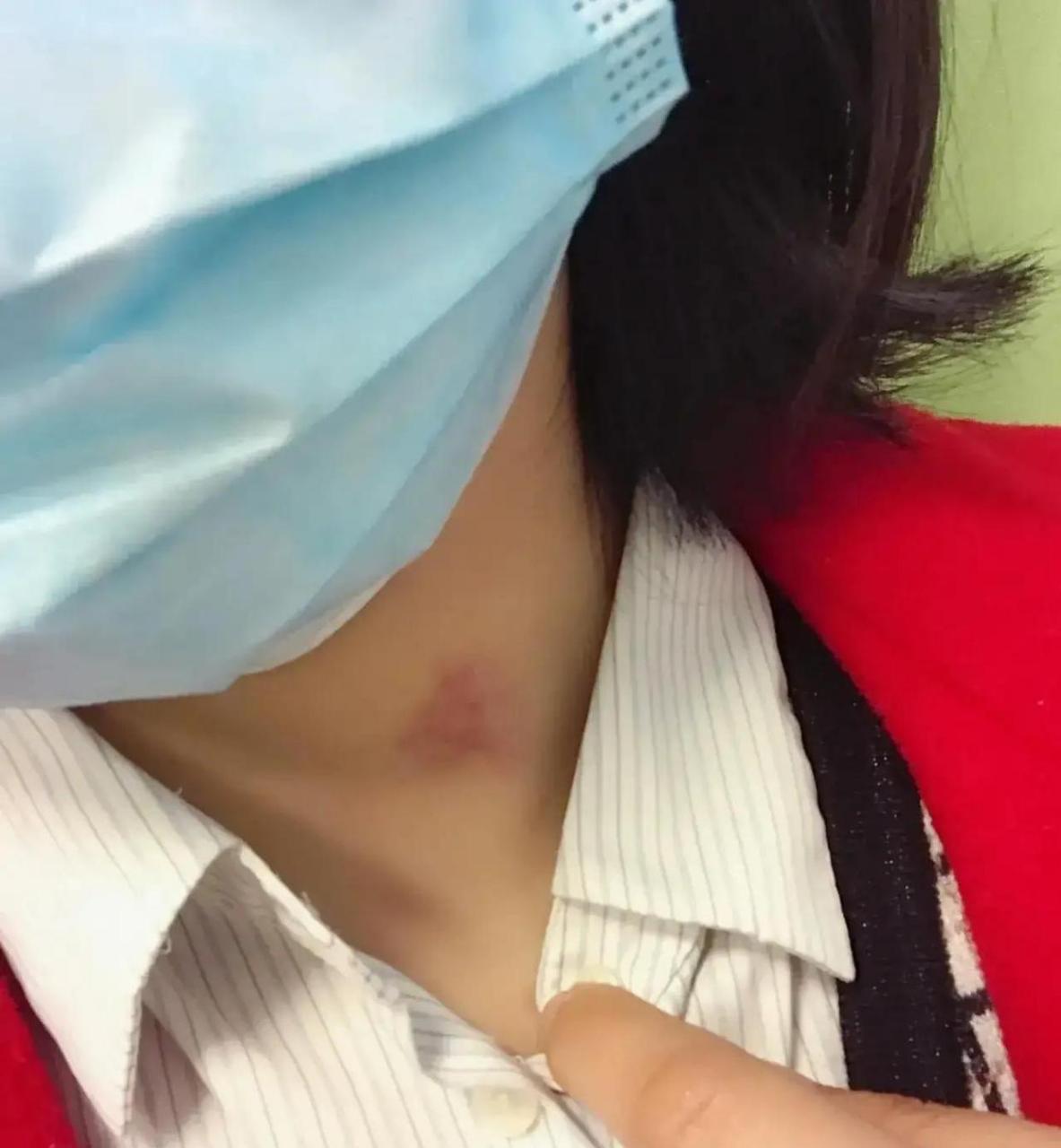 为了盖住草莓印,平时不遮住脖子的我,,把扣子全扣上了,不然同事一个个