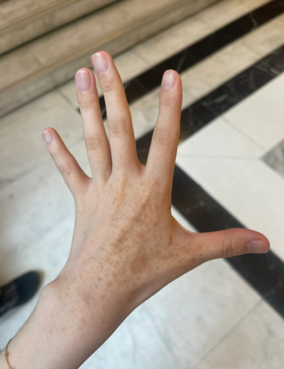 在解决手上晒斑怎么去除掉的问题上,我积累了一些心得,分享给大家.