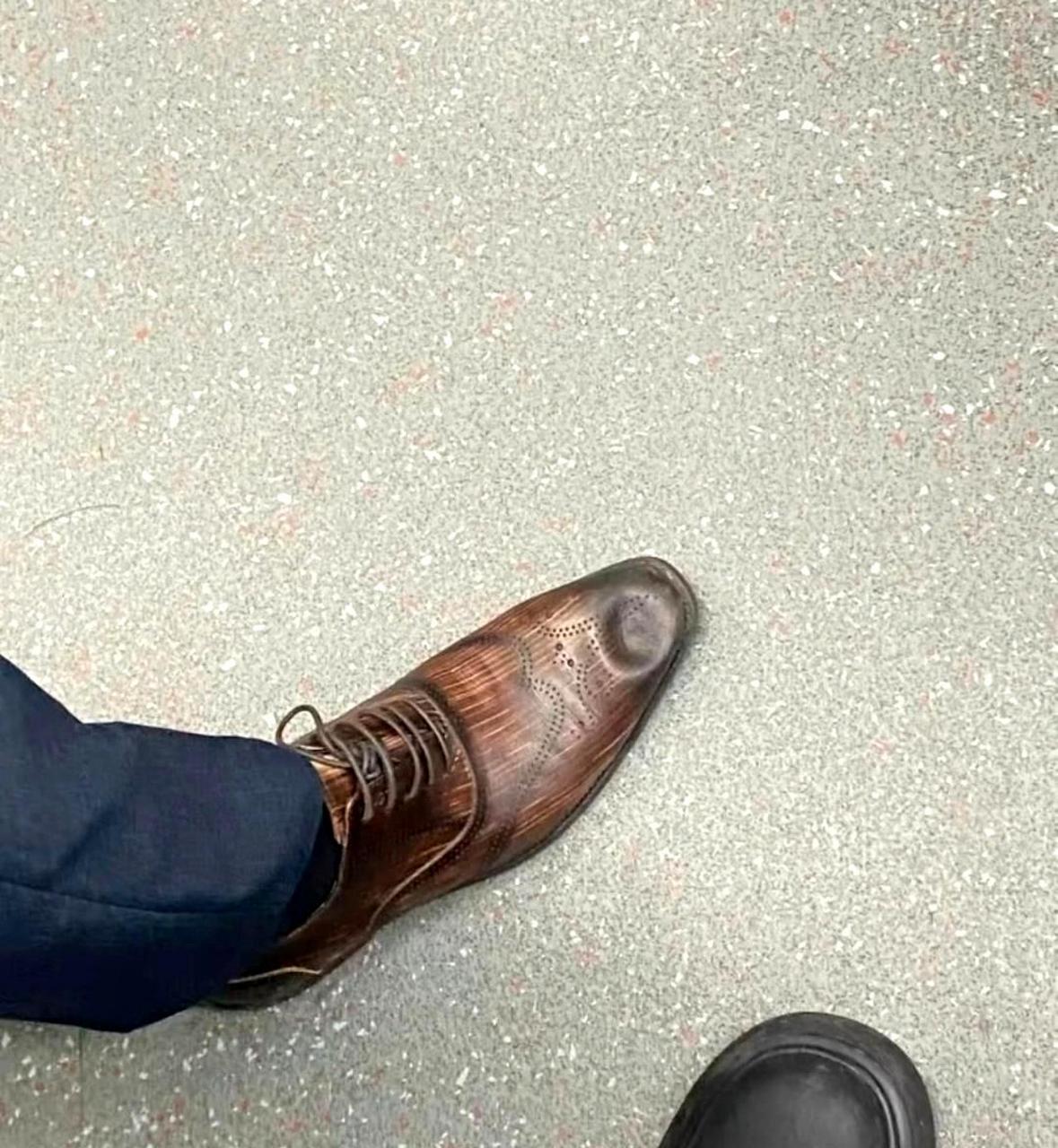 我该如何解释我不小心把别人的皮鞋踩扁了.