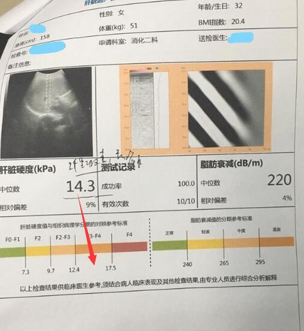 能恢复正常吗  1,除了肝穿刺外,肝弹性可以无创检测肝硬度值,结合肝胆