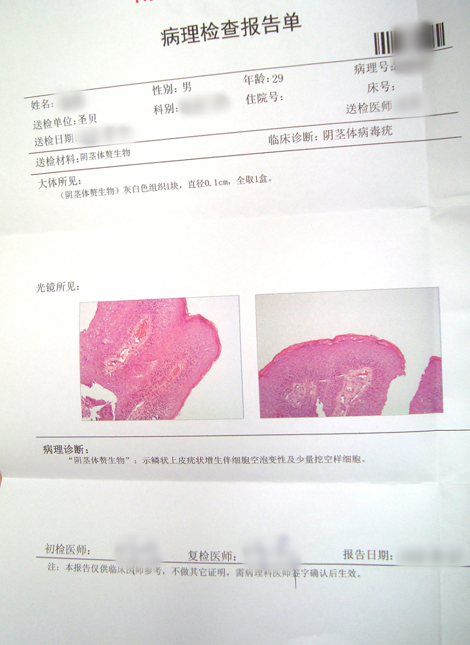 尿道口息肉的症状图片