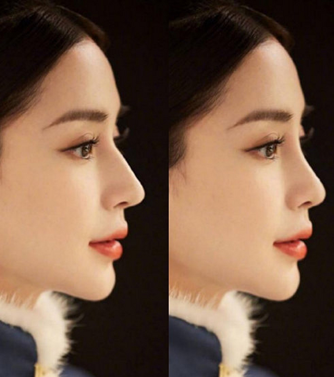 当angelababy,遇上了迪丽热巴的鼻子后…… 你们觉得哪个更好看?