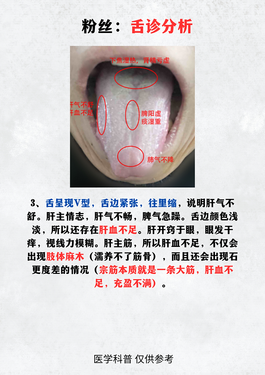 粉丝舌象分析 你的舌象是什么样的?