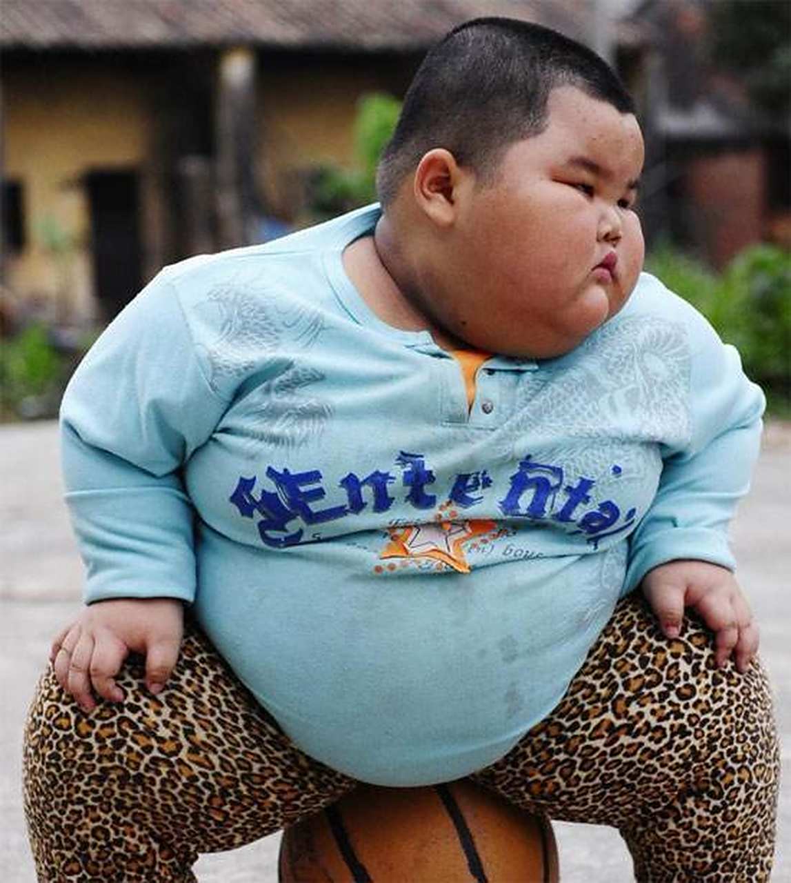 全世界过于肥胖的人比饥荒挨饿的人还要多.