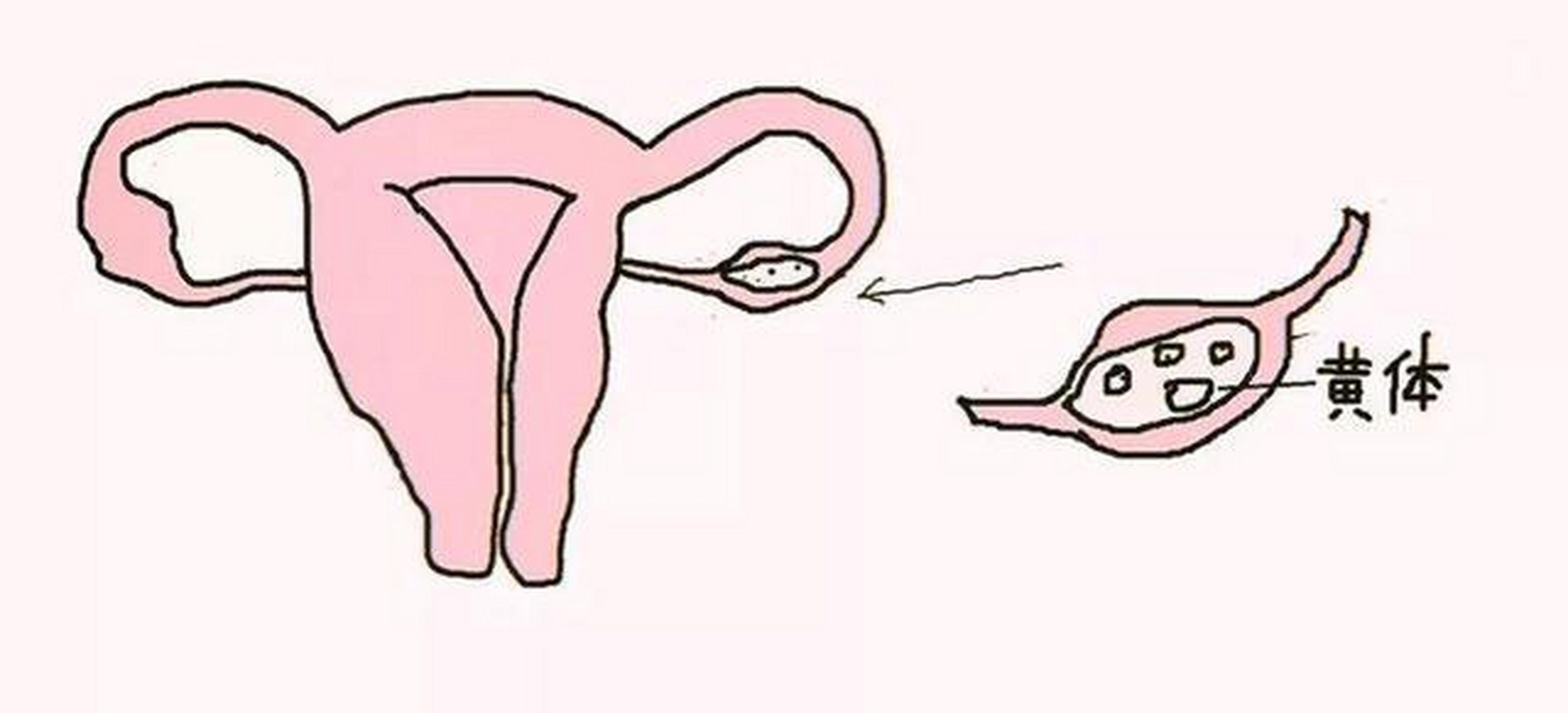 光彩!一招判断是不是黄体破裂"事半功倍"-第1张图片-追风博客