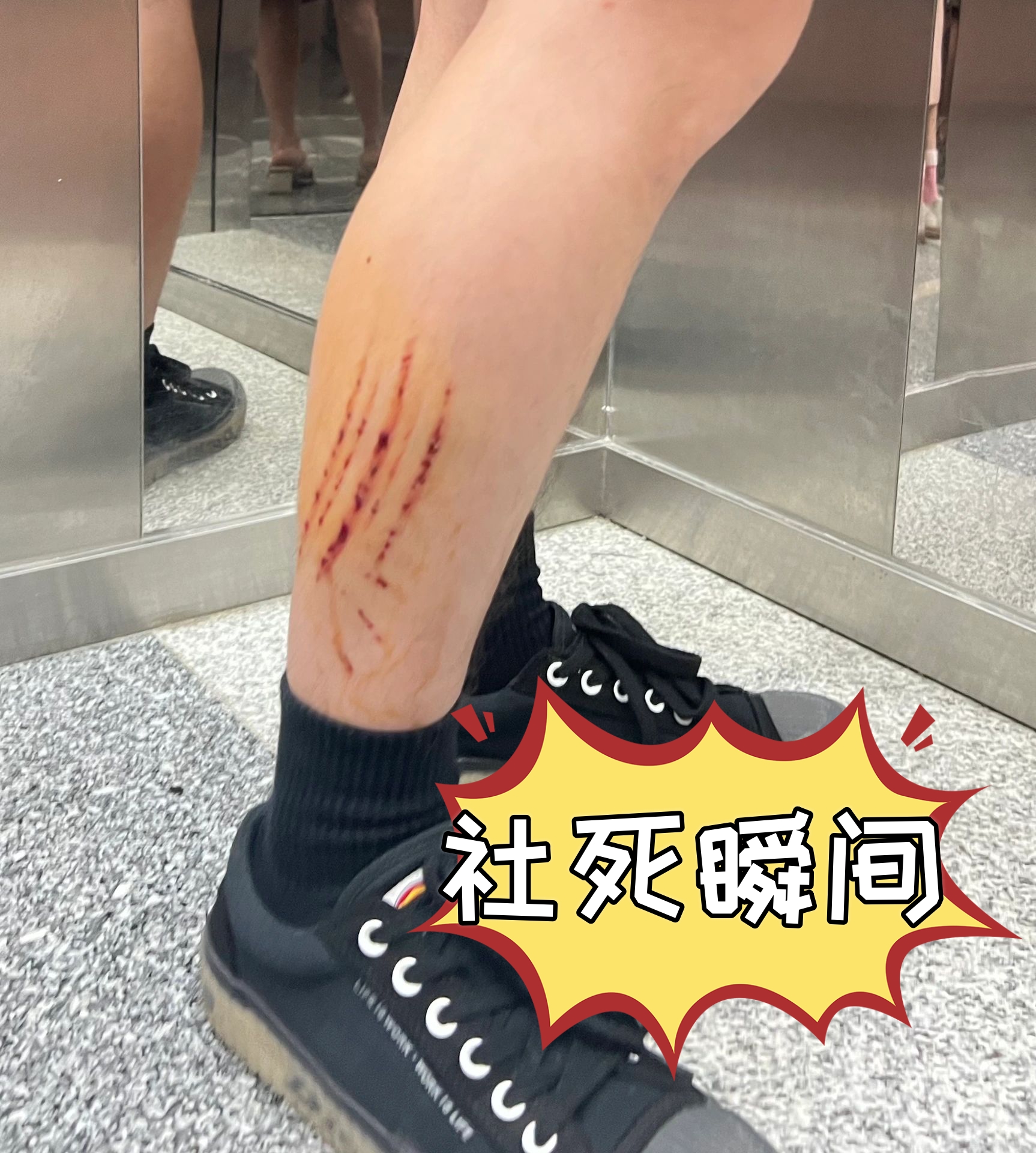 社死瞬间  早上下雨 又赶地铁 跑着下扶梯结果脚滑就摔倒在扶梯上 摔