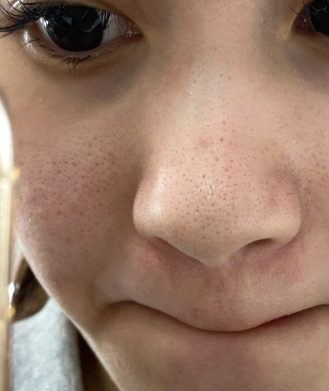 收缩毛孔是很多人关注的问题,因为扩张的毛孔会给肌肤带来瑕疵感.