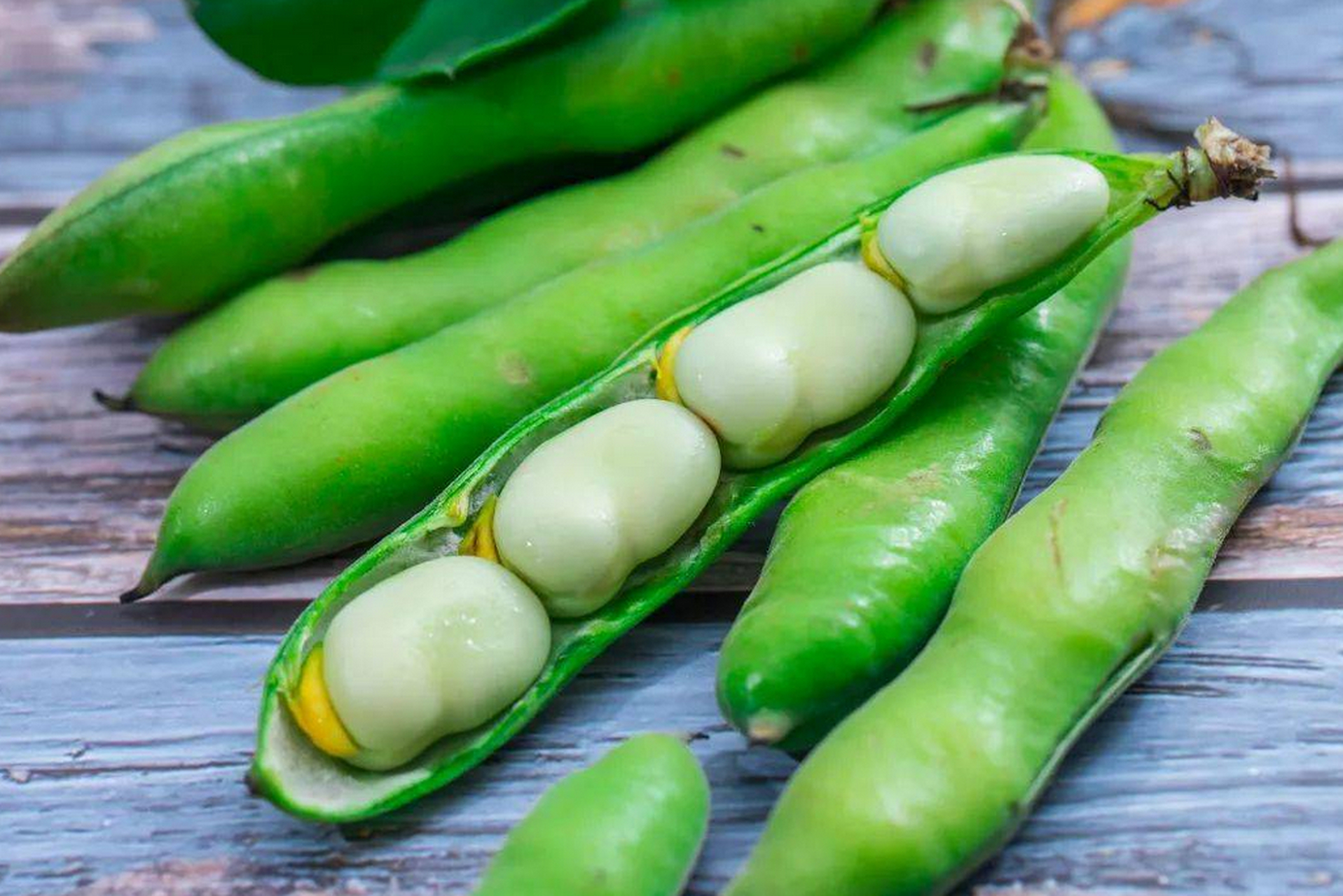 蚕豆病,医学术语称之为"红细胞葡萄糖-6-磷酸脱氢酶(g-6-pd)缺乏症"