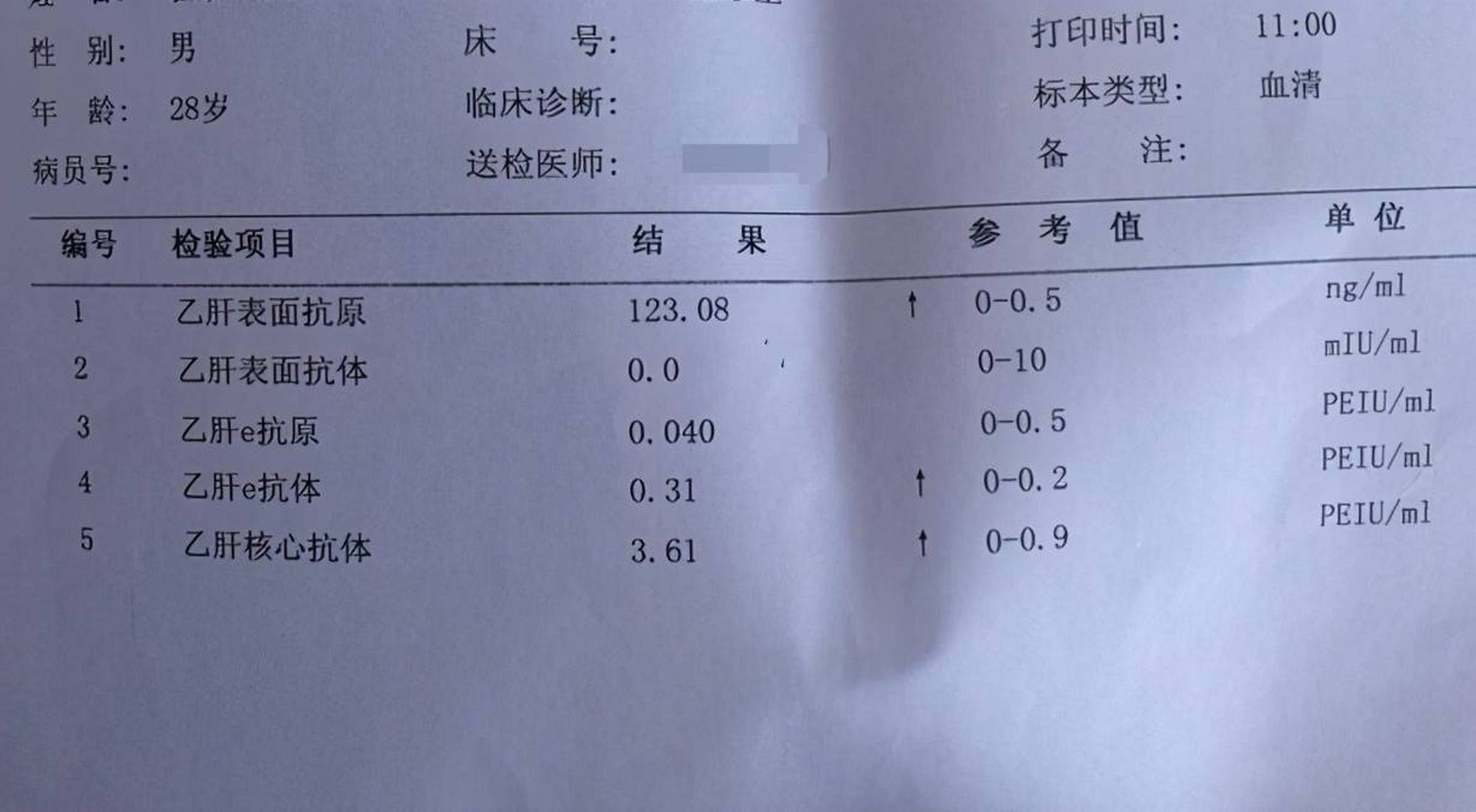 关于乙肝五项报告单,这里有详细解答 乙肝五项俗称乙肝两对半,是乙型