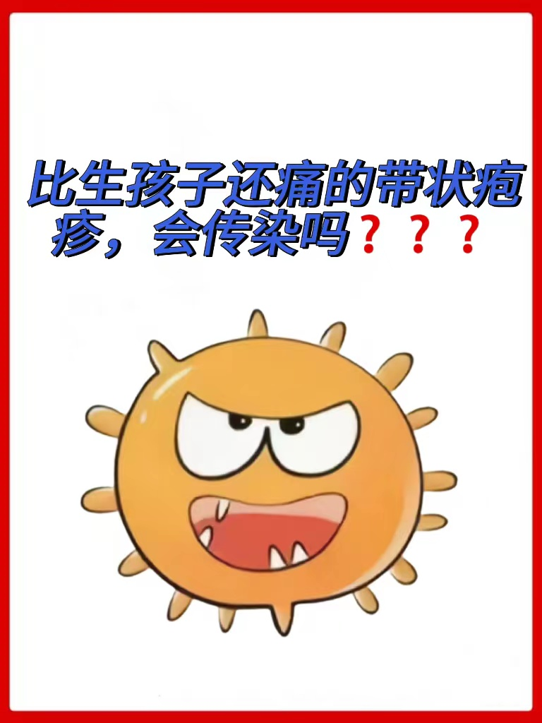 会传染吗  带状疱疹也就是大家所熟知的蛇盘疮,蛇缠腰,这是一种由水痘