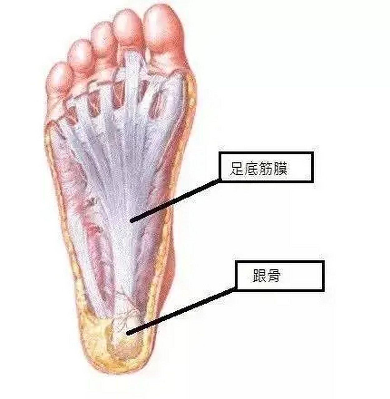 足底筋膜炎怎么治疗 足底筋膜炎症状表现 足底筋膜炎最常见症状是脚跟