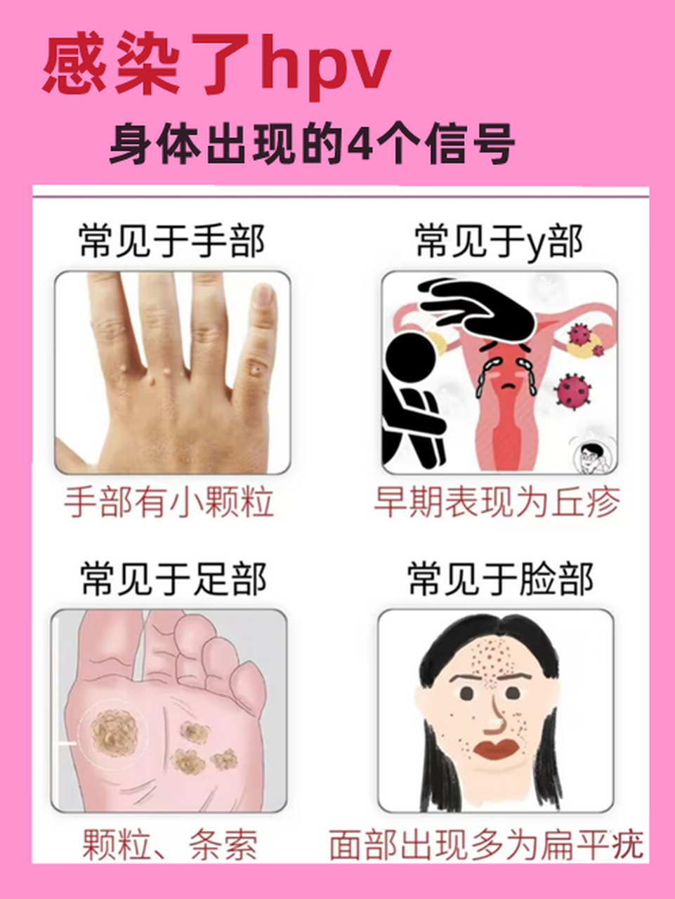 信号 ①常见于手部: 手部有一粒粒凸起的小颗粒 ②常见于y部: 早期