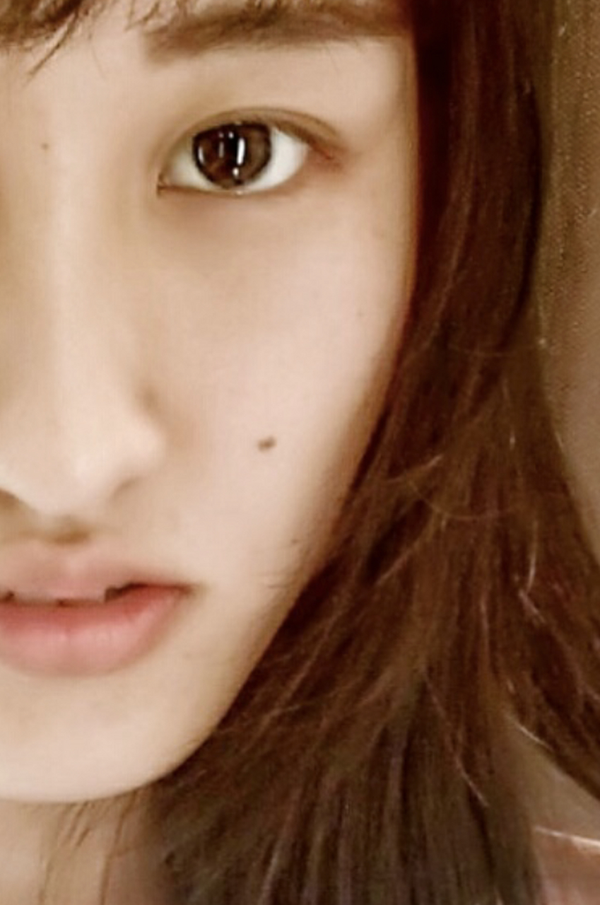 激光点痣# 激光点痣一个多少钱 激光点痣可以帮助我们去掉脸上的黑