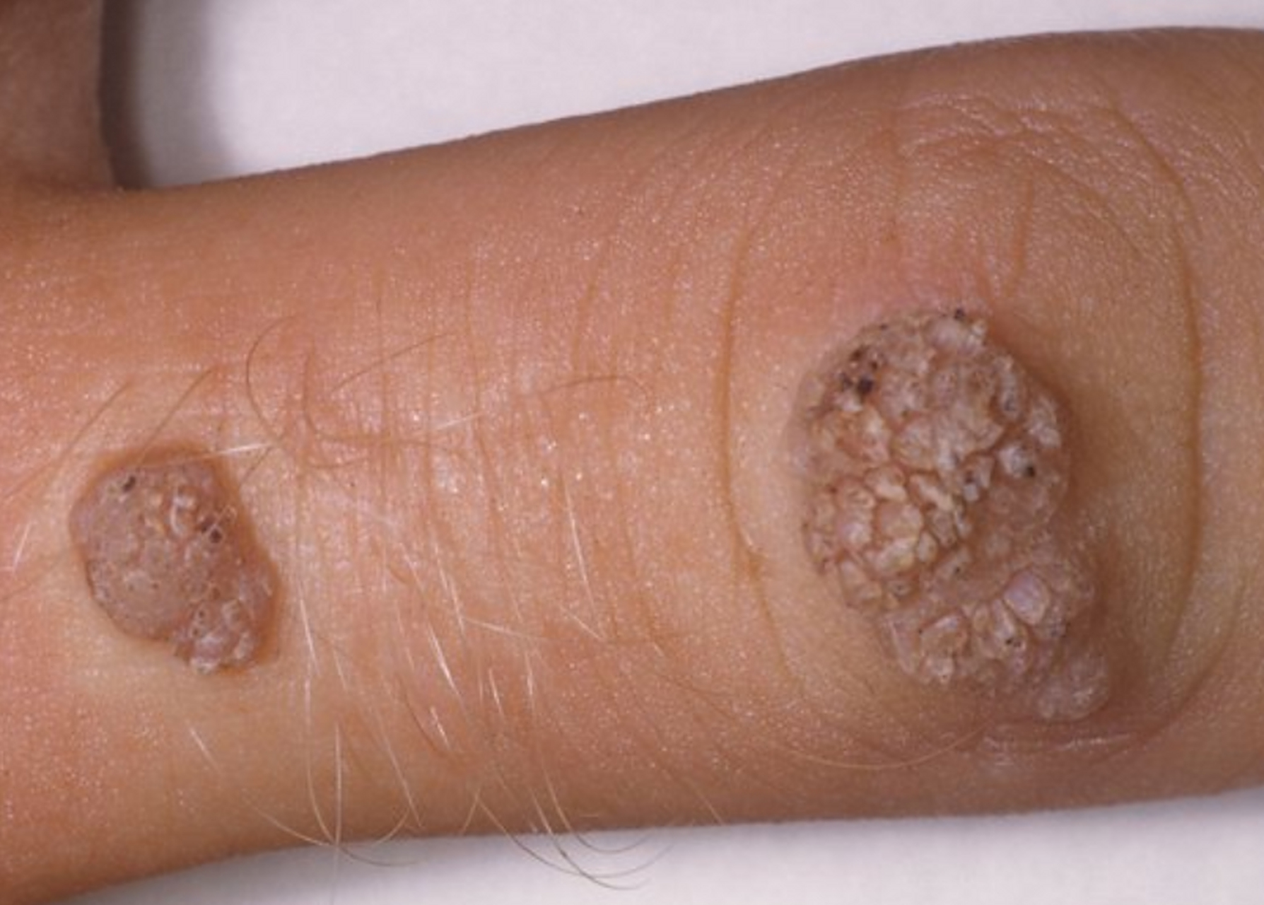 "  不一定哦,这可真的要看你那个小菜花长在哪里了.