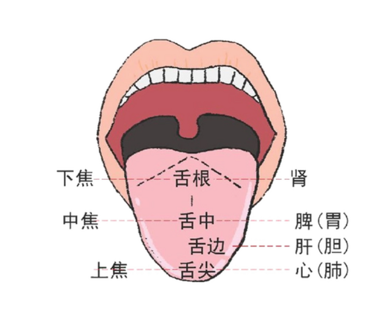 《中医舌诊舌质辨证》  淡舌:设色较正常浅淡,主虚证,寒证,多见于血虚