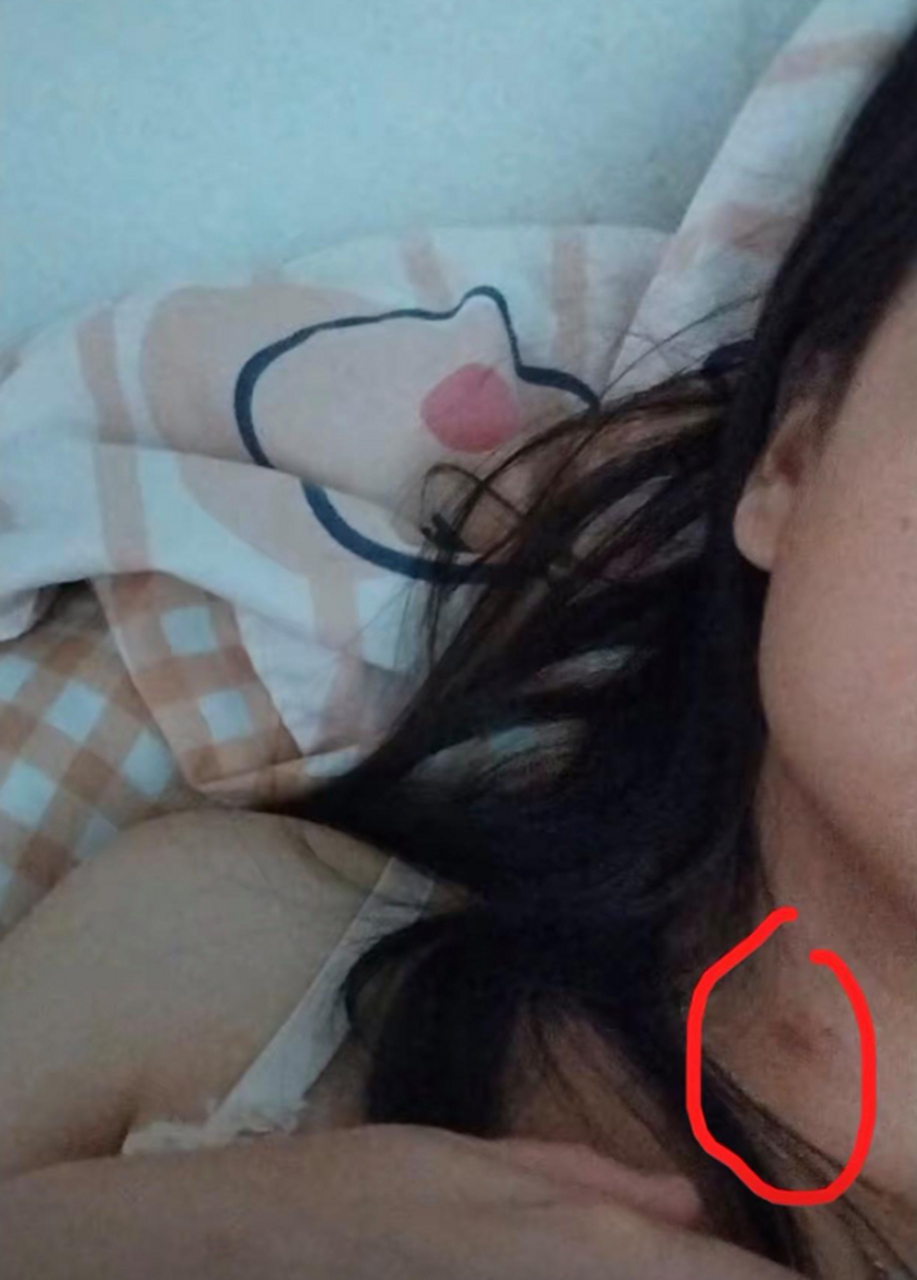第一次谈恋爱,大家帮我看看这是不是草莓印?