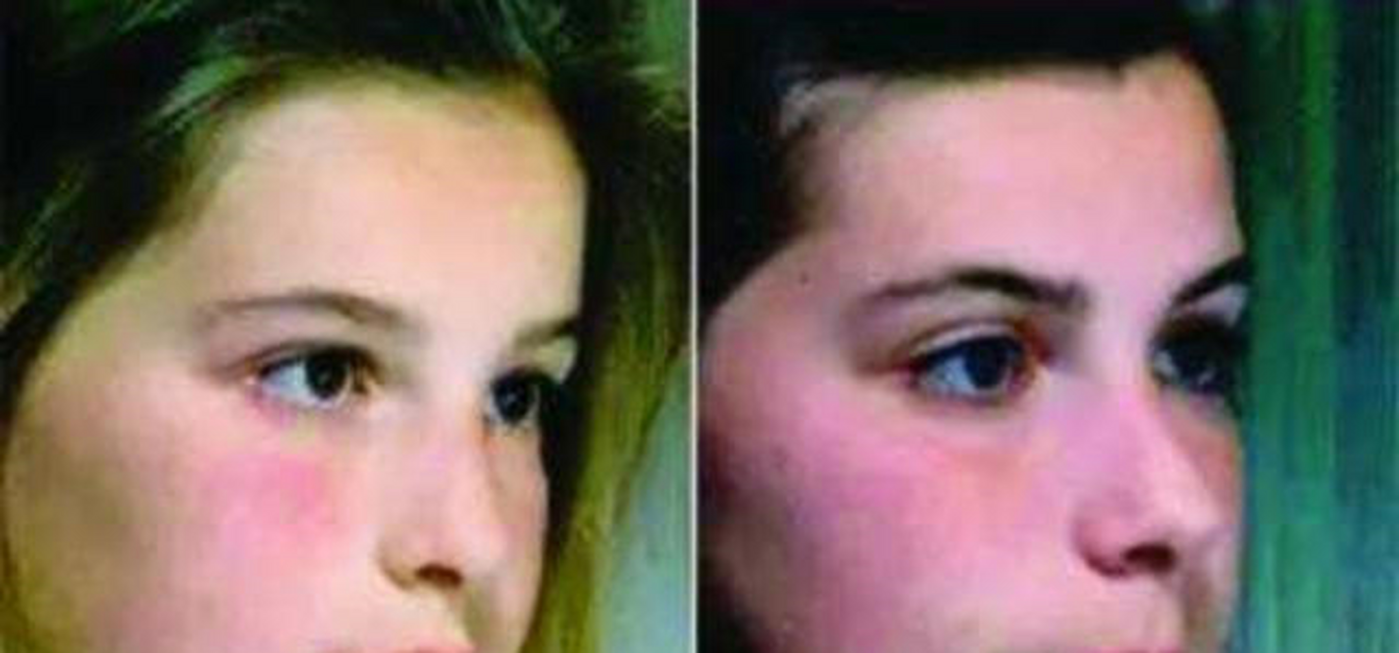 因为正常情况下孩子睡觉时舌体是抵在上颚的,而张嘴睡觉时孩子的舌体