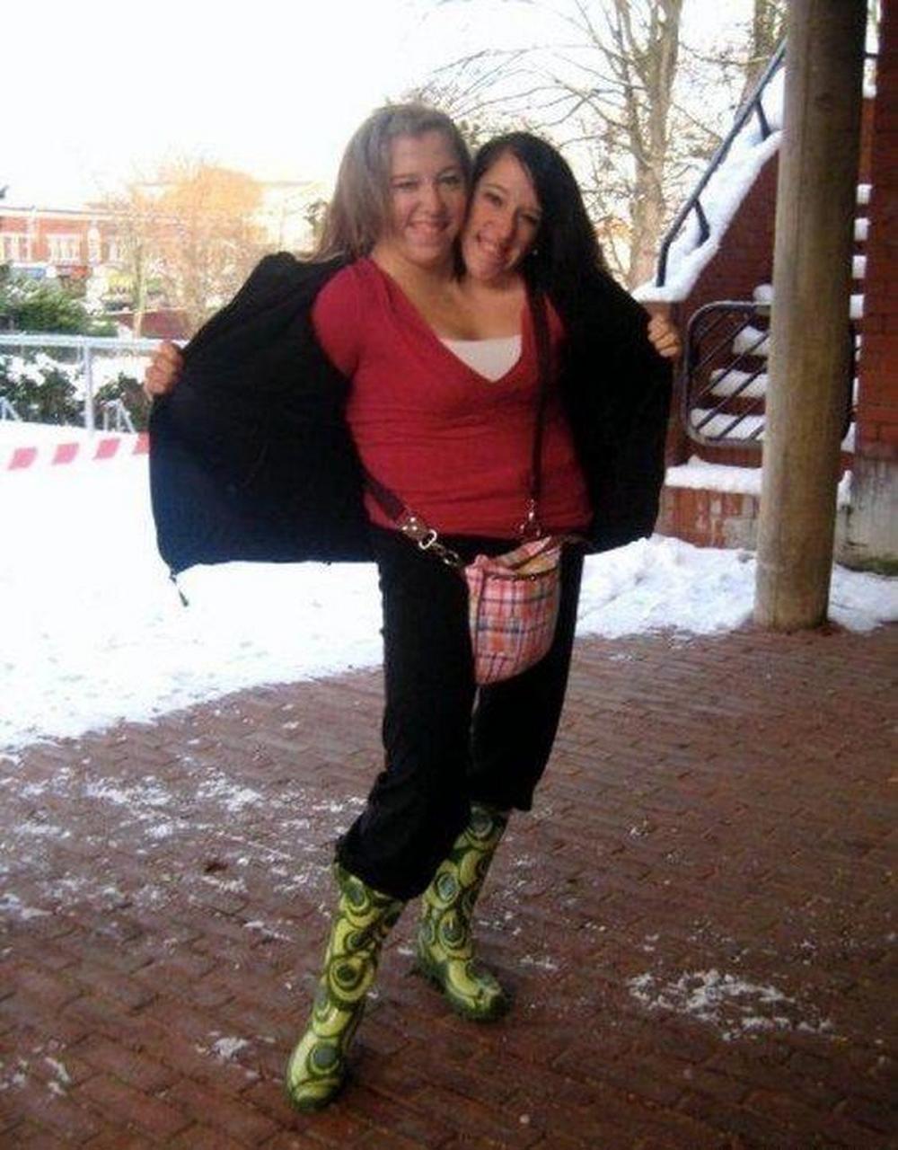 领动计划# 双头人,真是世界之大,无奇不有. #人物##摄影##照片