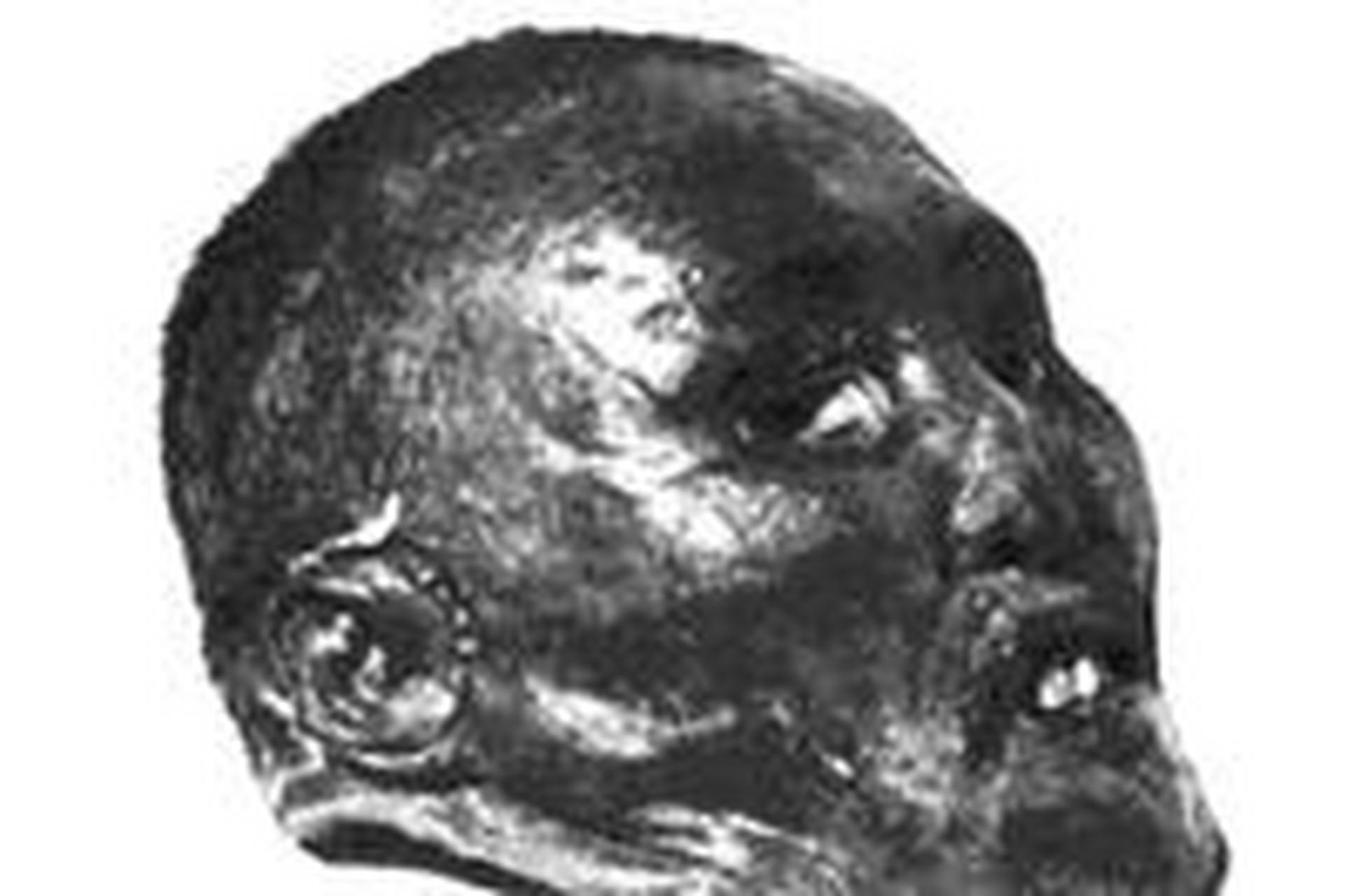 圣彼得堡博物馆里,一颗面相狰狞的头颅浸泡在福尔马林中.