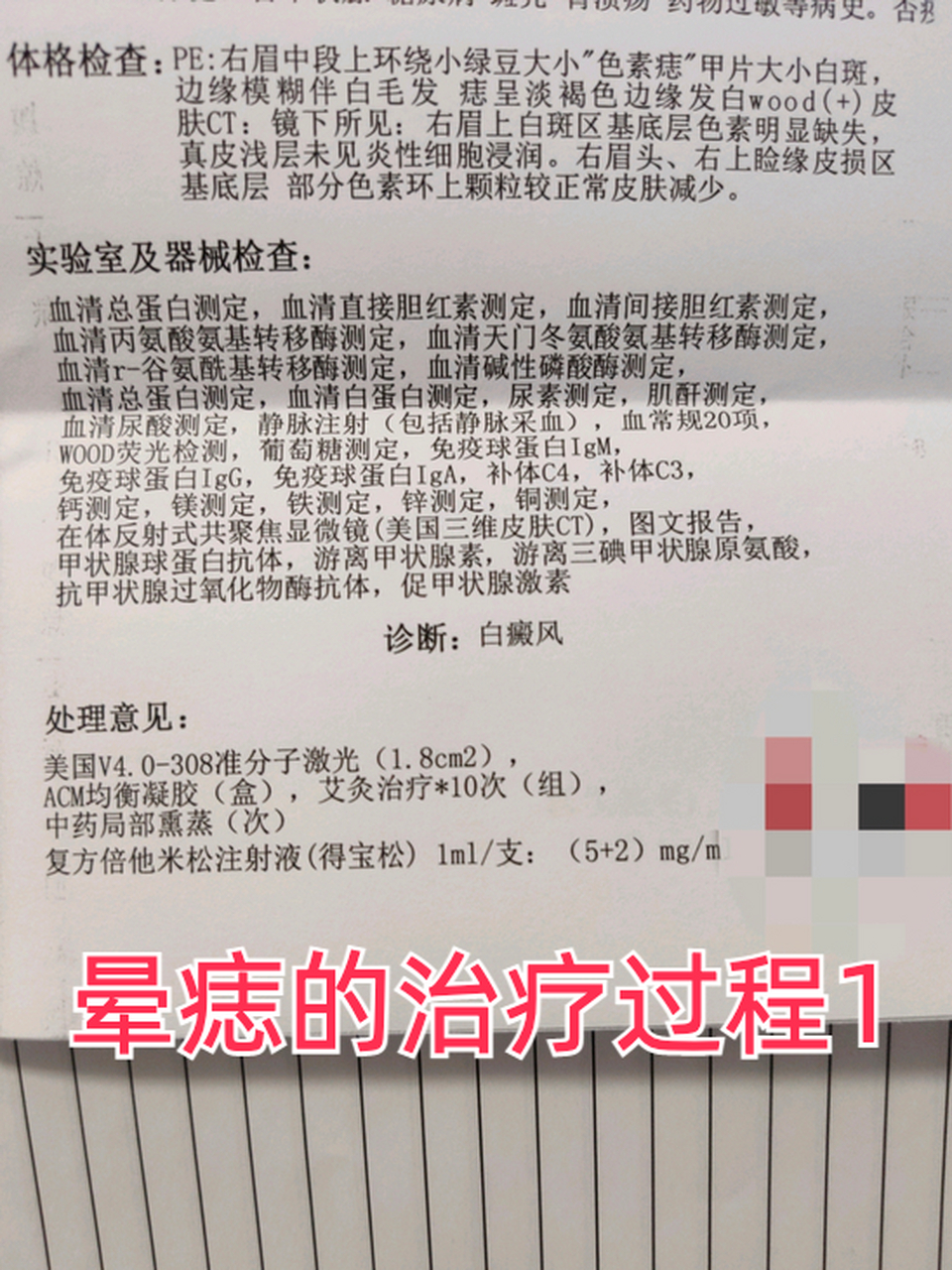 晕痣de治疗过程 1#晕痣# #健康经验笔记# #疾病治疗经验#   10.