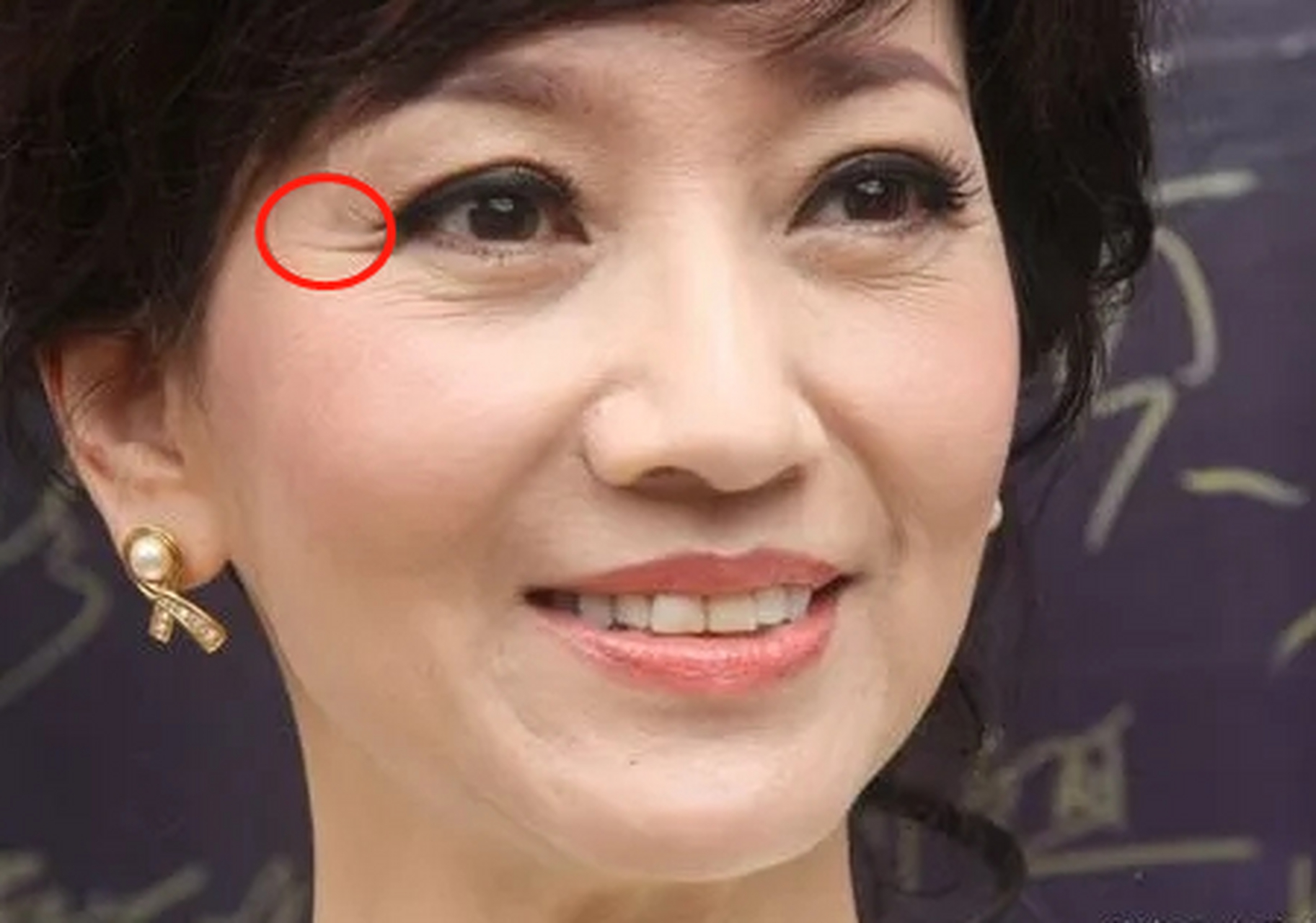 弹弹弹,真能弹走鱼尾纹吗?给你支2招!