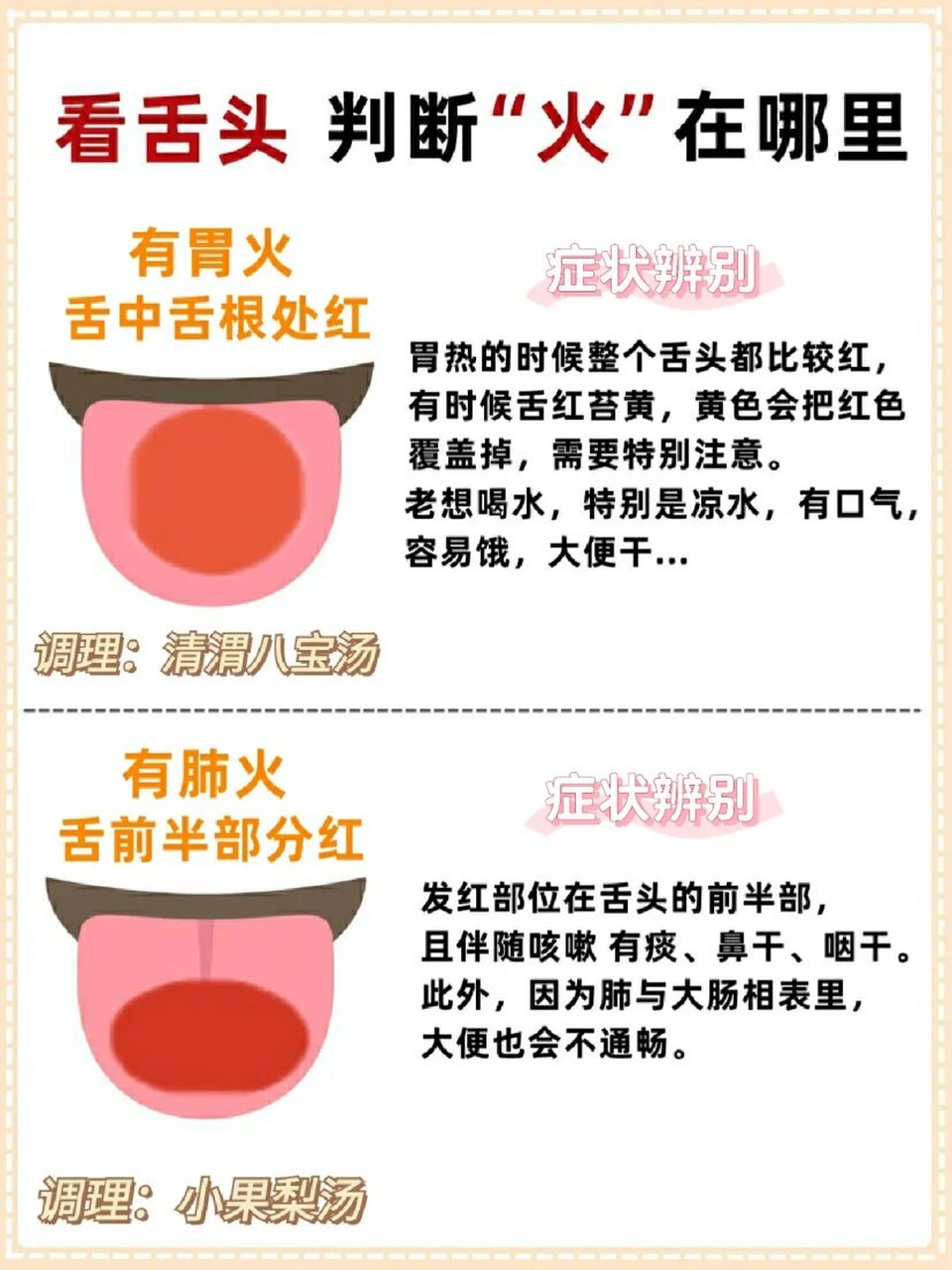 今天分享一套观舌相的方法,只要看舌头,就能判断"火"在哪里!