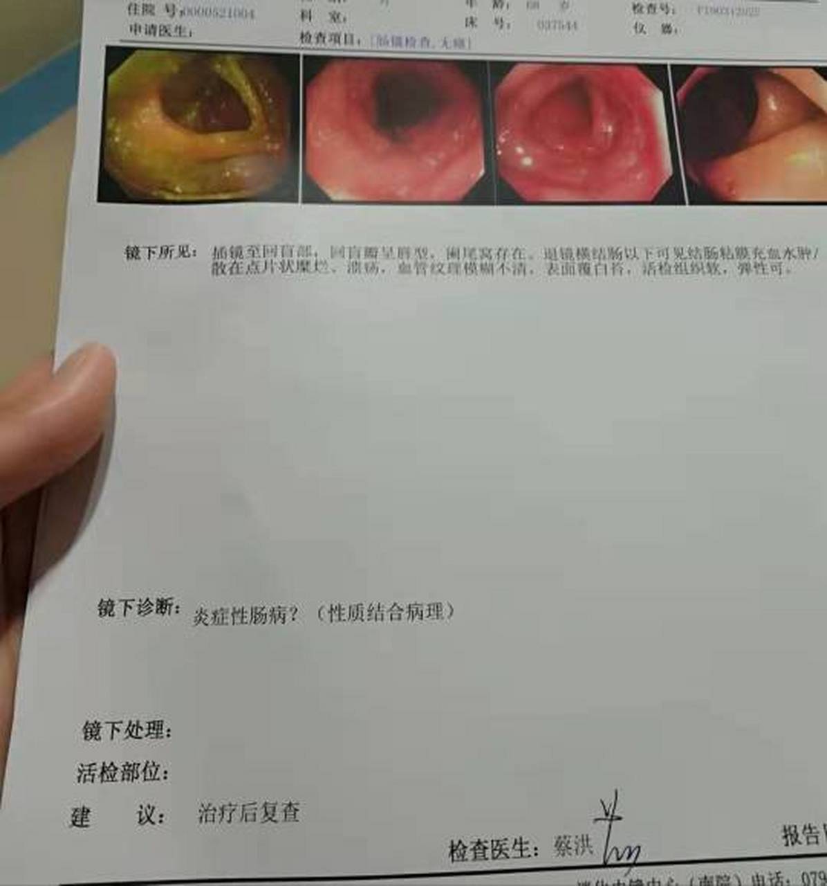 结肠炎早期有四大症状,警惕这些症状:  11566 腹痛:左下腹或脐下