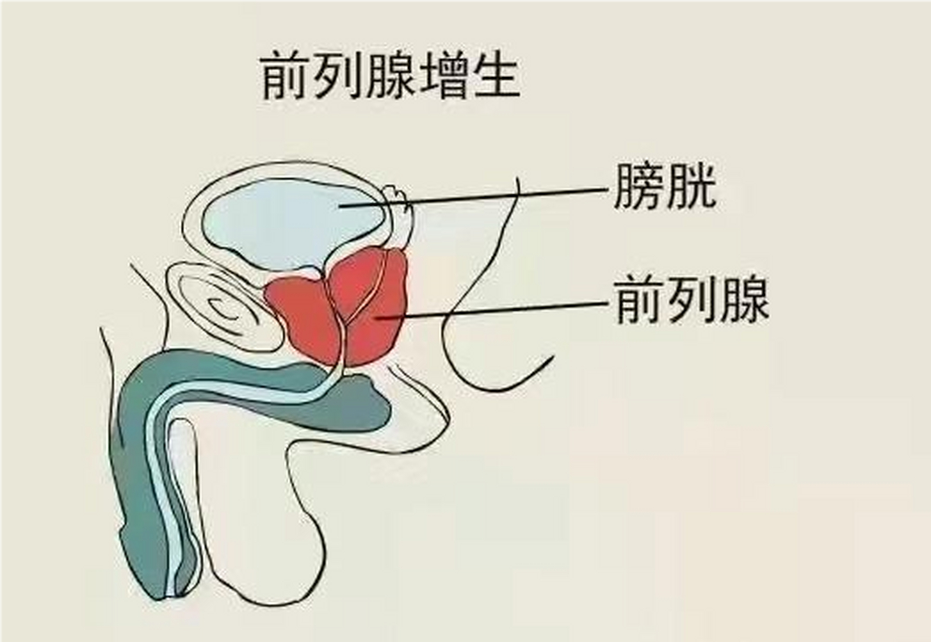 前列腺位置高清图图片