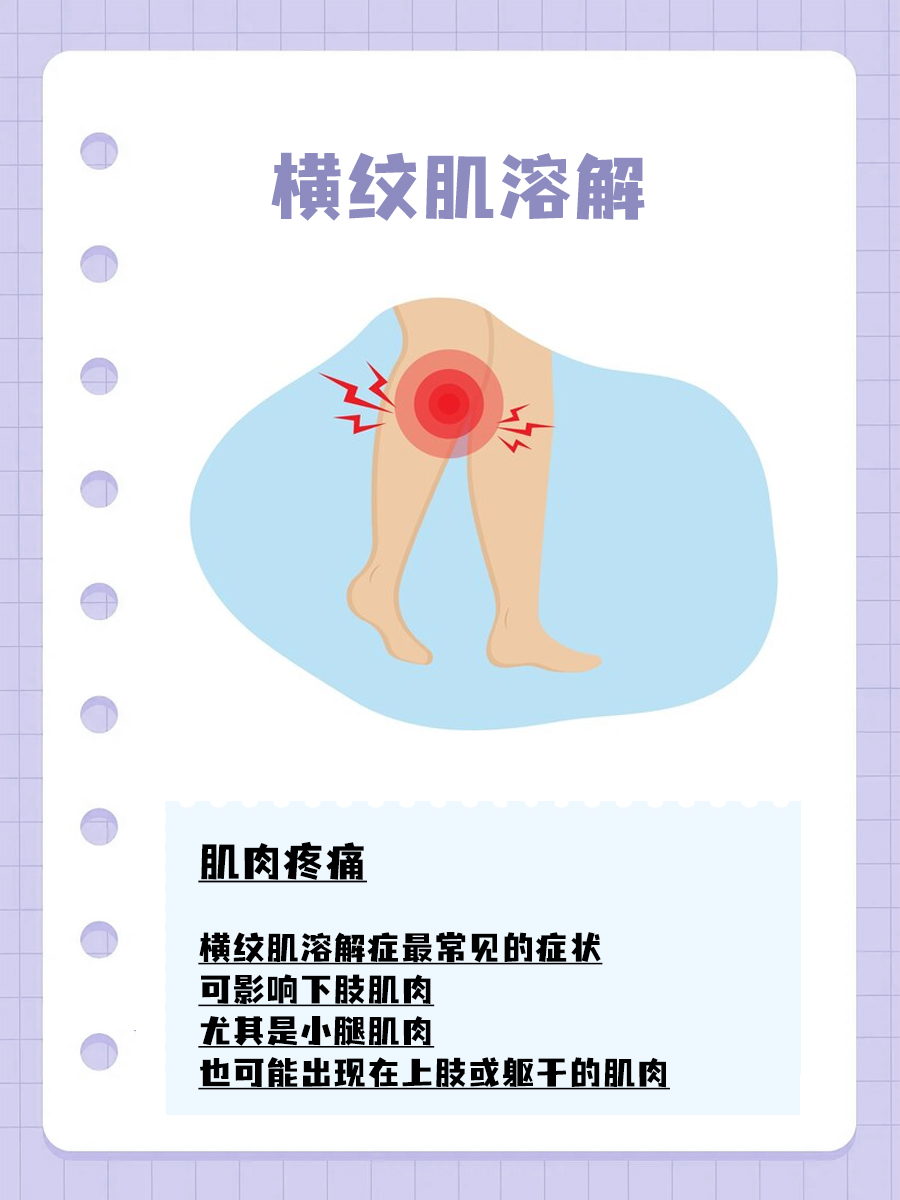 []出现这些症状,小心是横纹肌溶解!