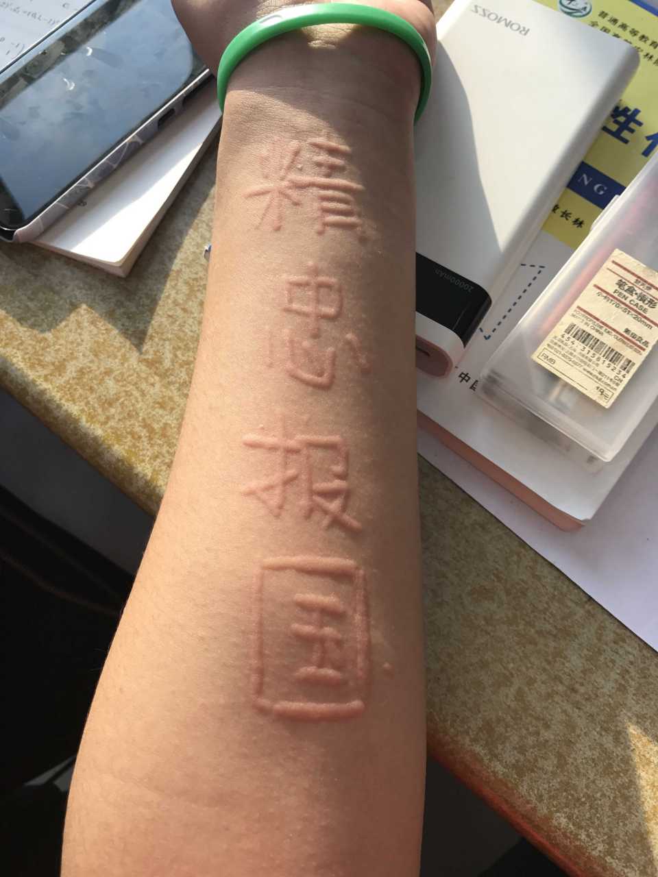 大多数人可能不知道,荨麻疹是会让人窒息死亡的!