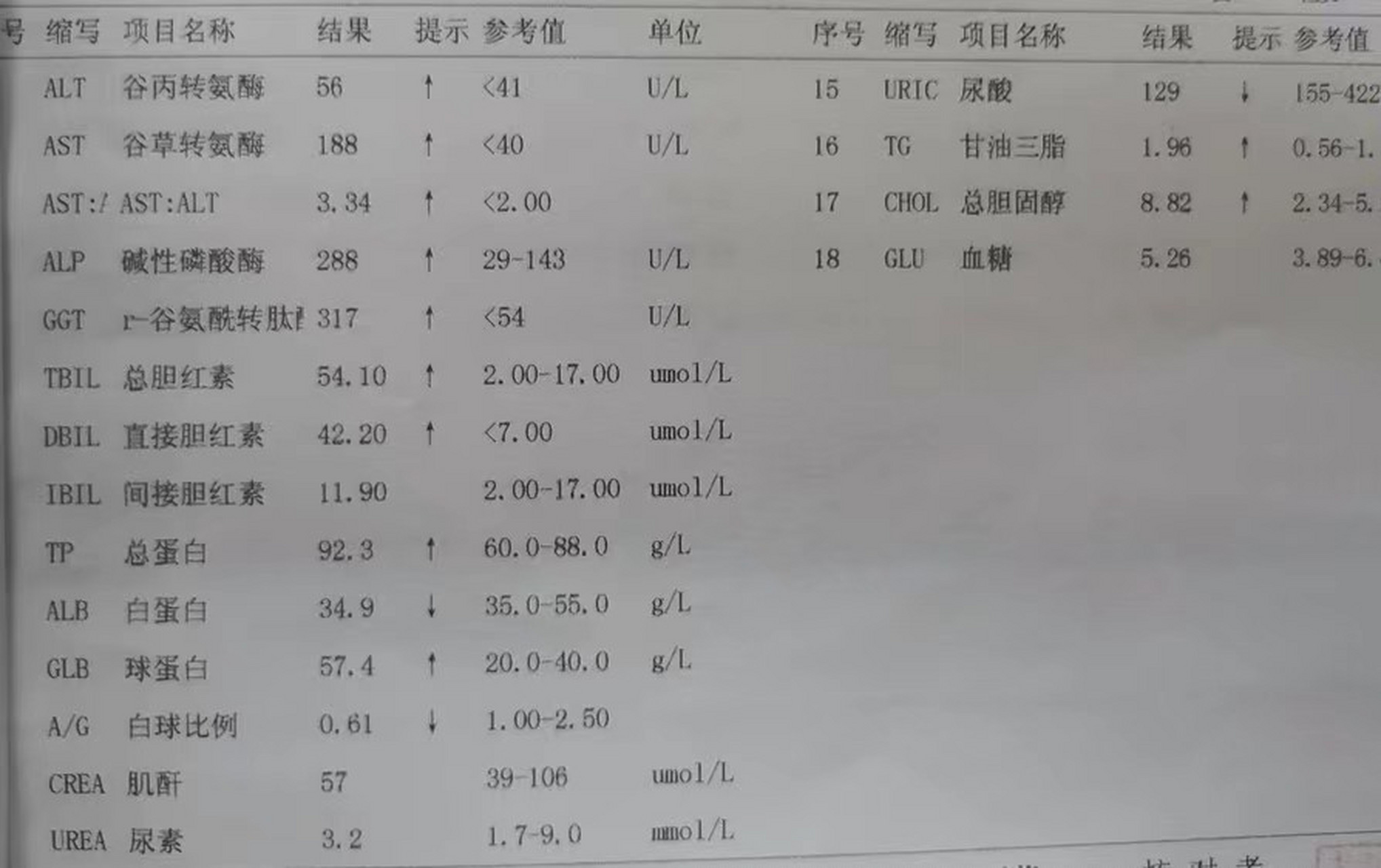 这是一个肝硬化患者的化验单.